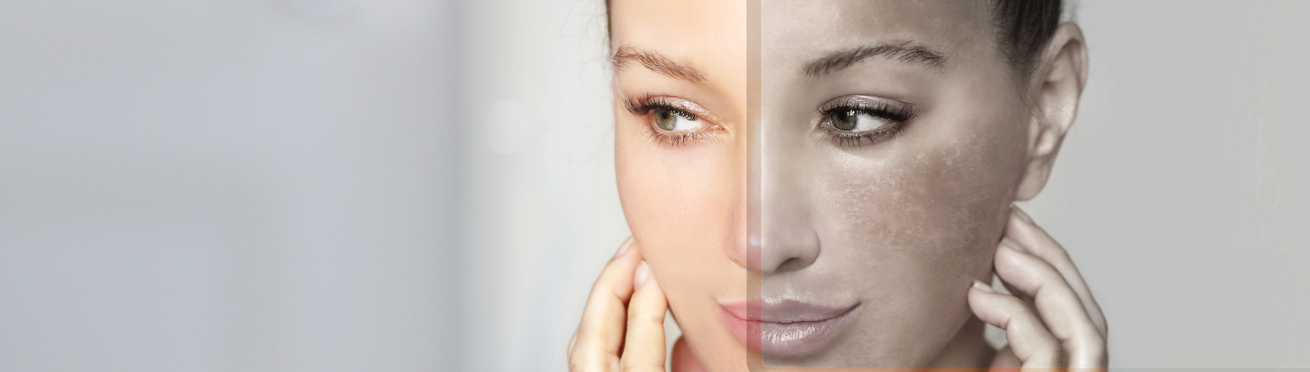 Hydroquinone: everything you need to know about this skincare ingredient