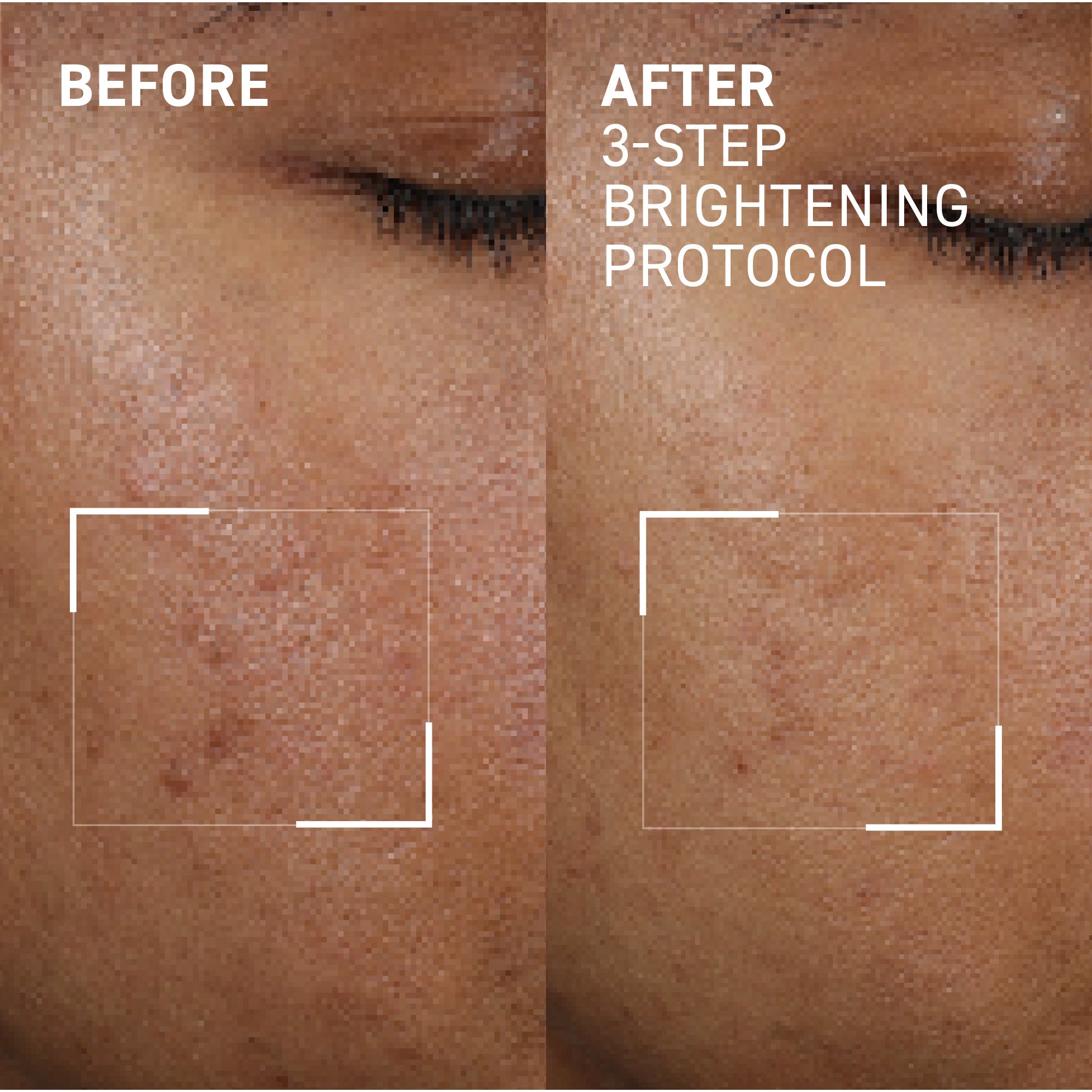 Advanced Brightening Serum