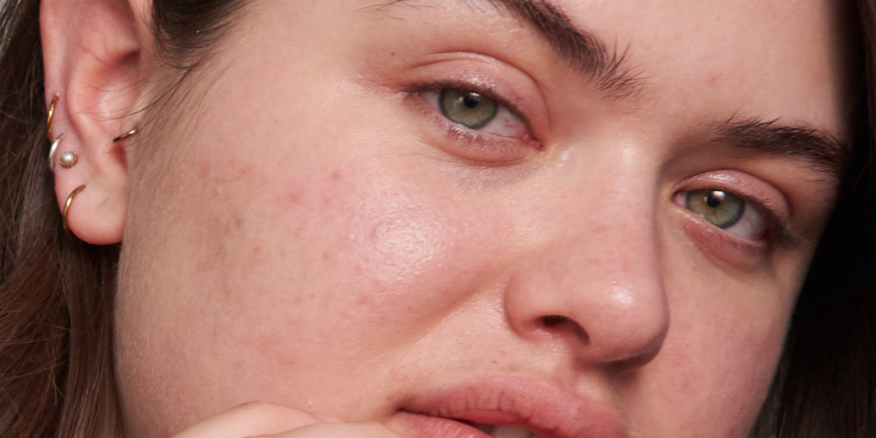 Dr. Brandt Skincare Blemishes collections