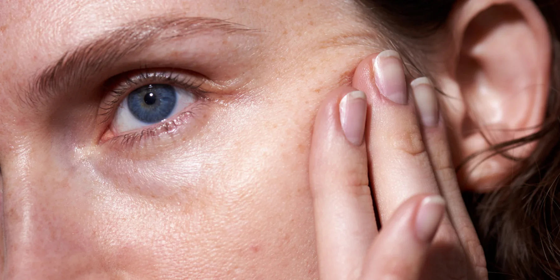 Dark Circles & Puffy Eyes