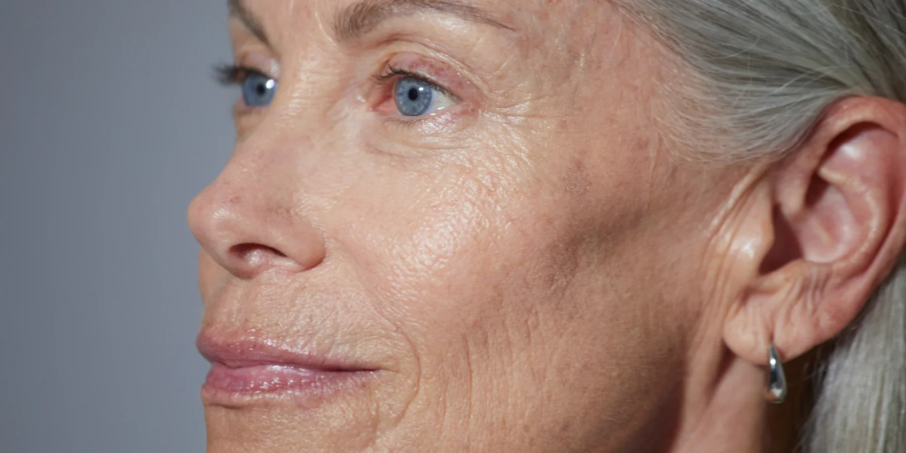 Fine Lines + Wrinkles