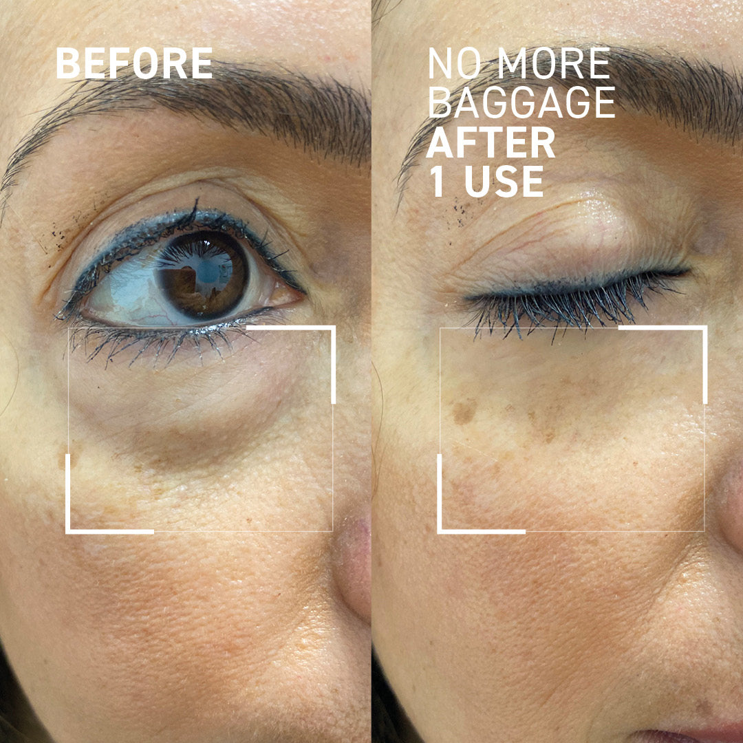 Needles No More No More Baggage Eye Gel 7g