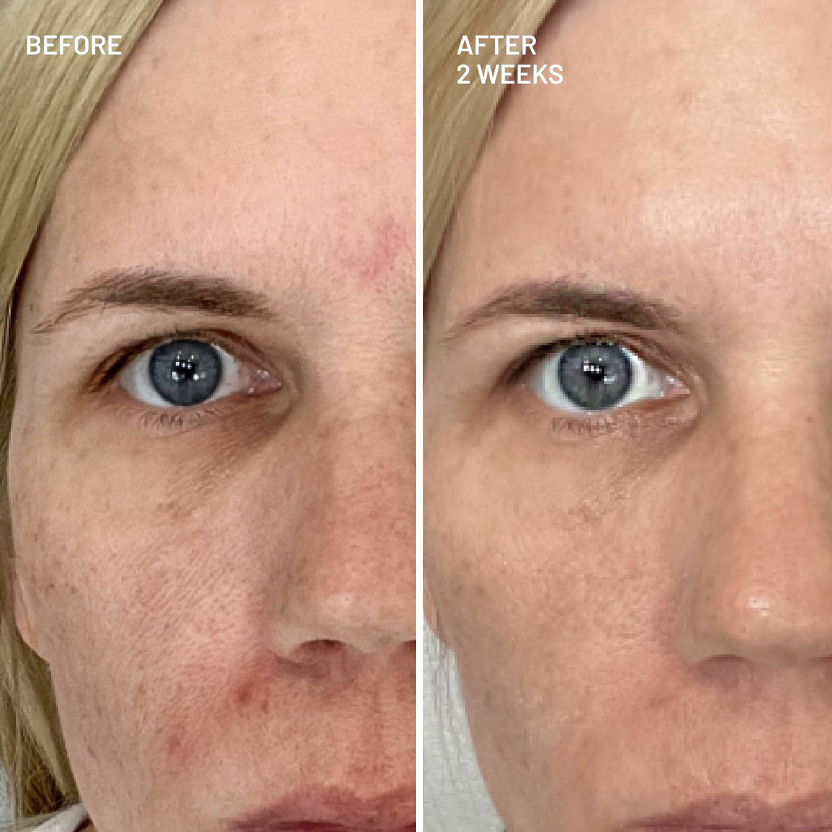 Advanced Pore Cleansing Duo