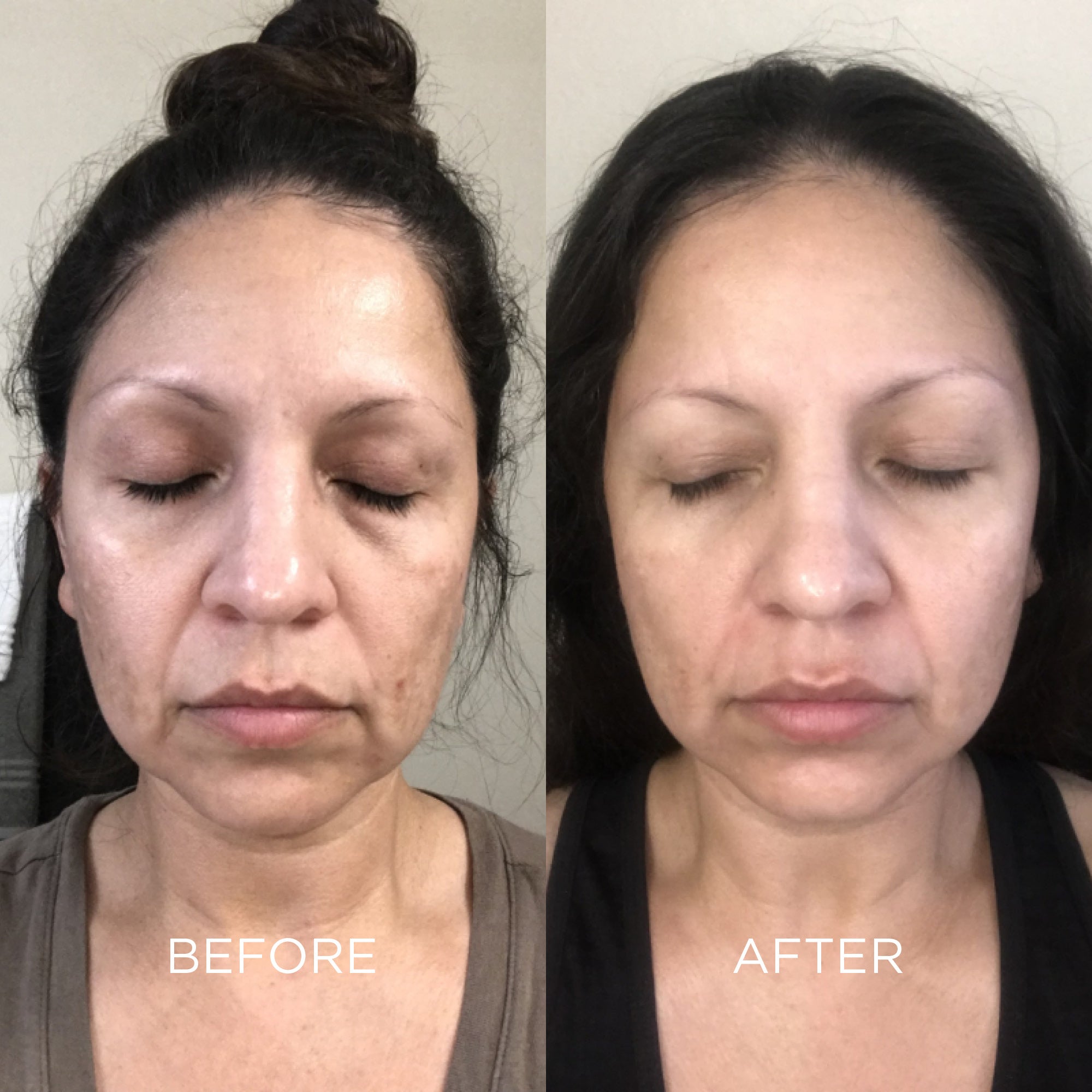 4-in-1 Instant Results Kit