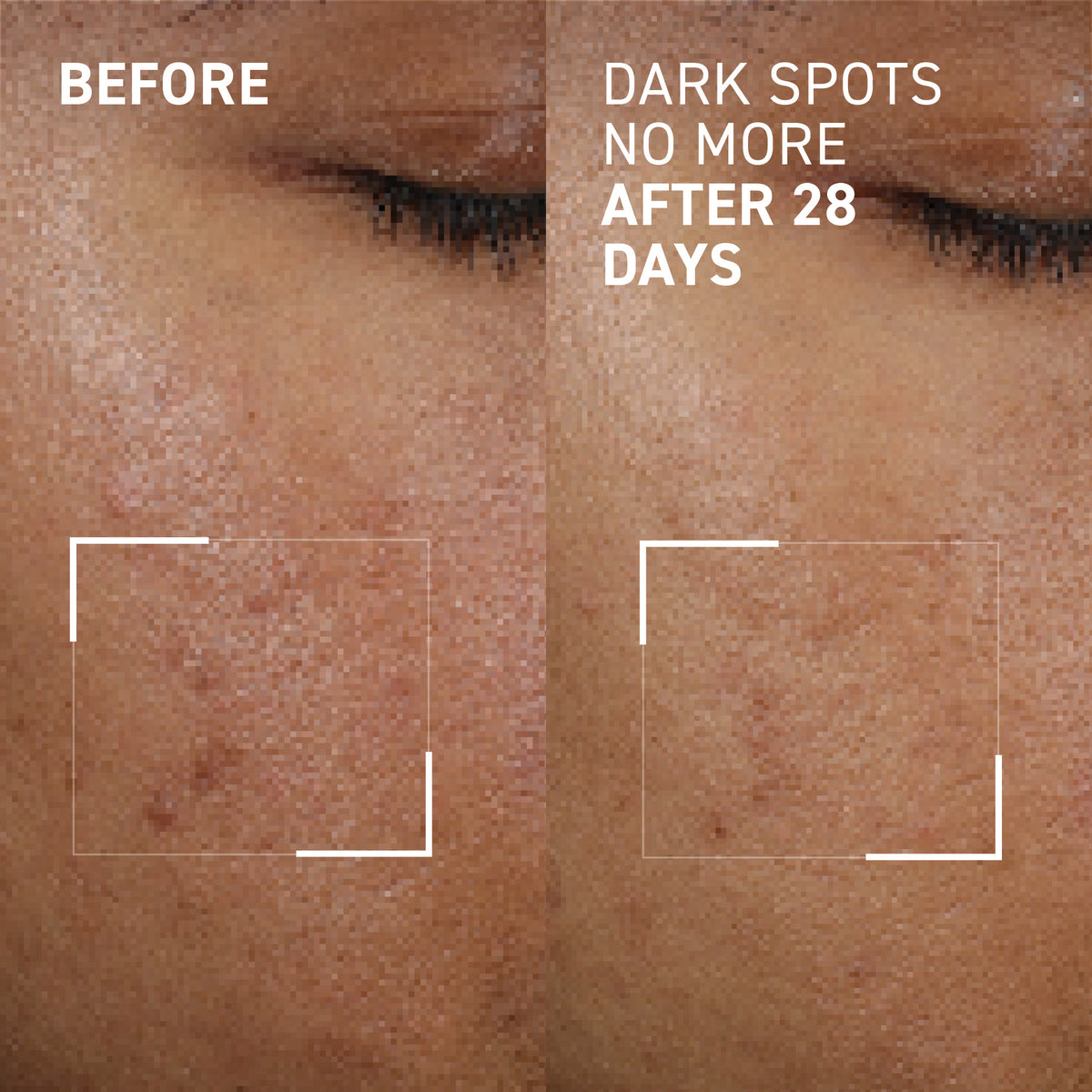 DARK SPOTS NO MORE®