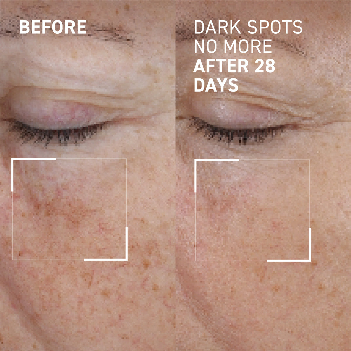 DARK SPOTS NO MORE®