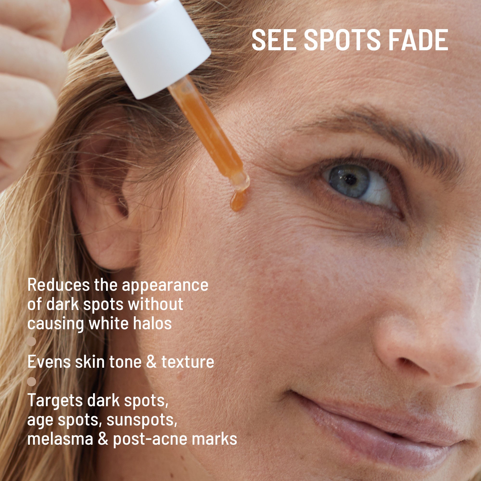 Dark Spots No More®