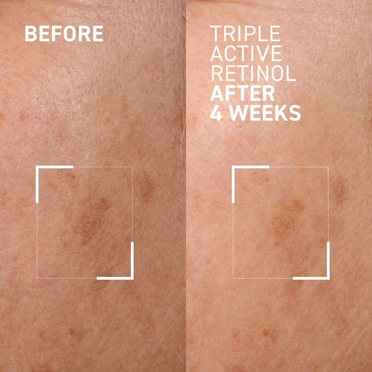 TRIPLE ACTIVE RETINOL