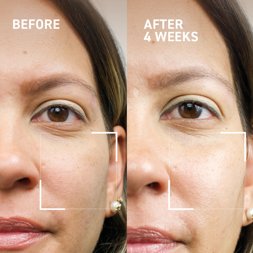 Microneedling Renewing Kit