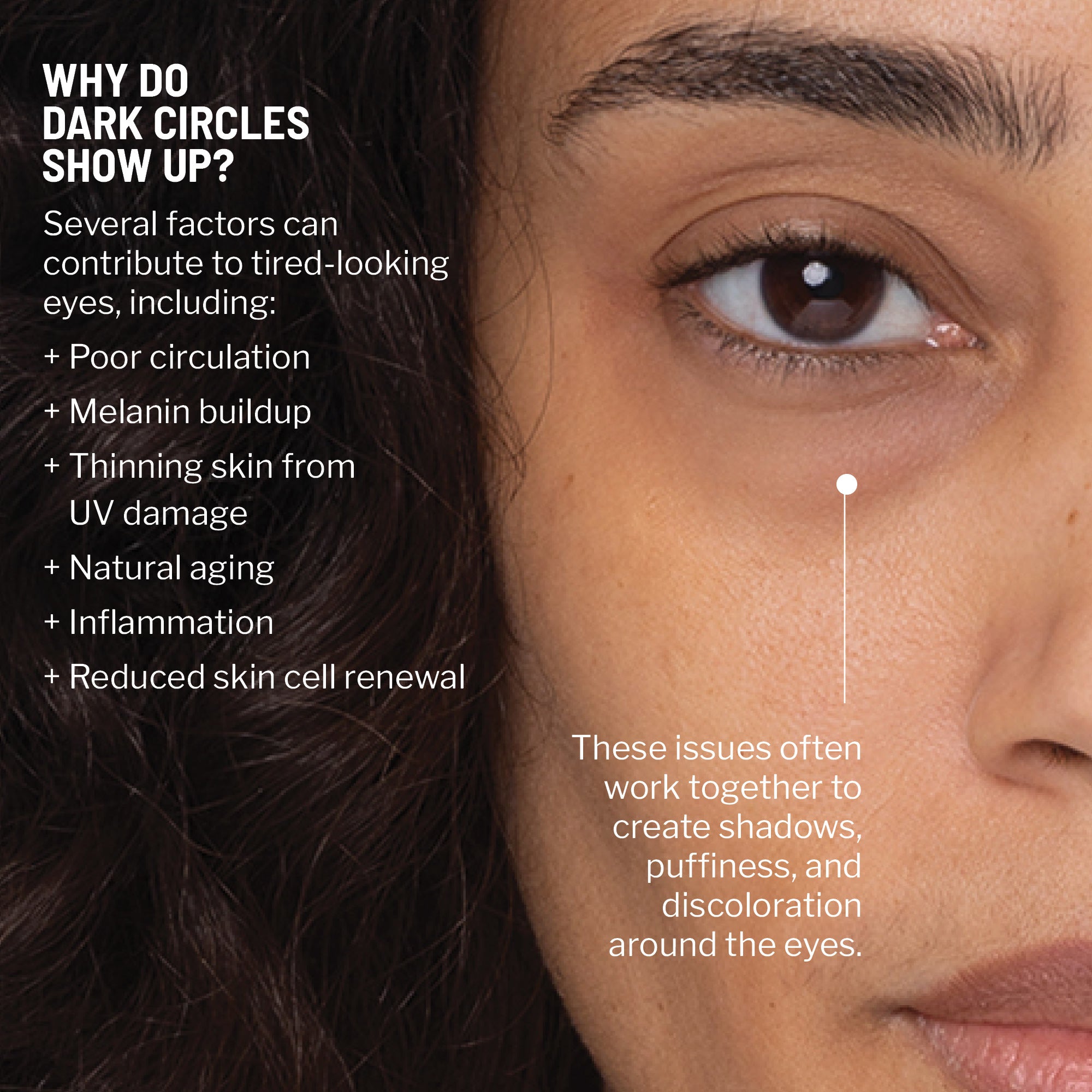 Dark Circles Correcting Eye Duo