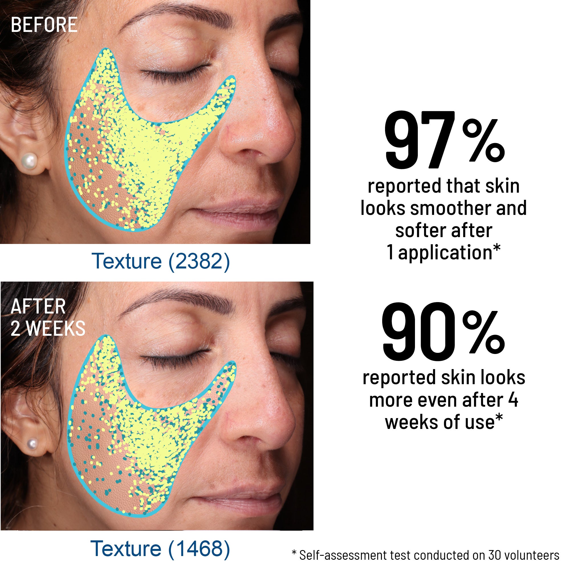 Advanced Microdermabrasion Face Exfoliator