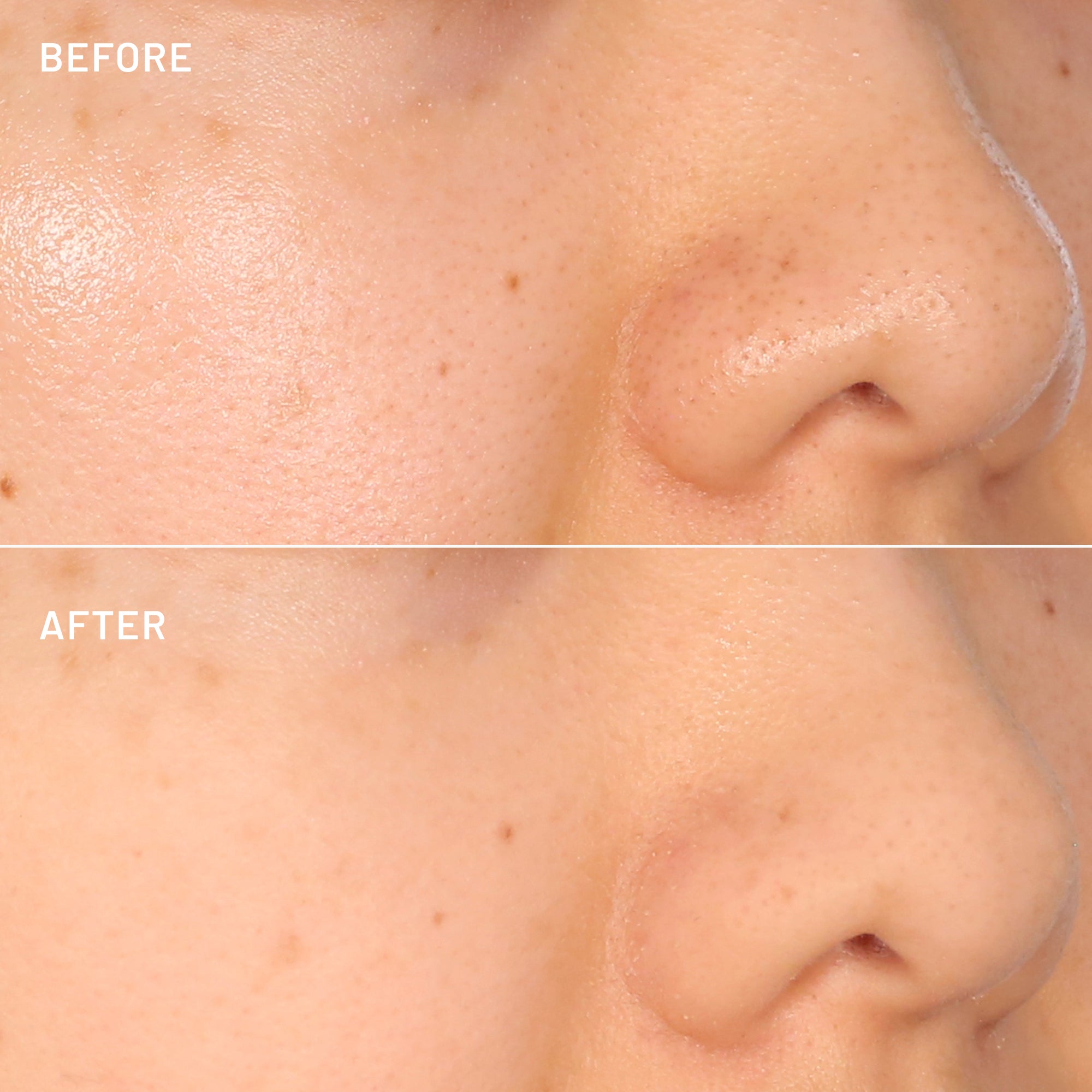The Pore-Fect Set