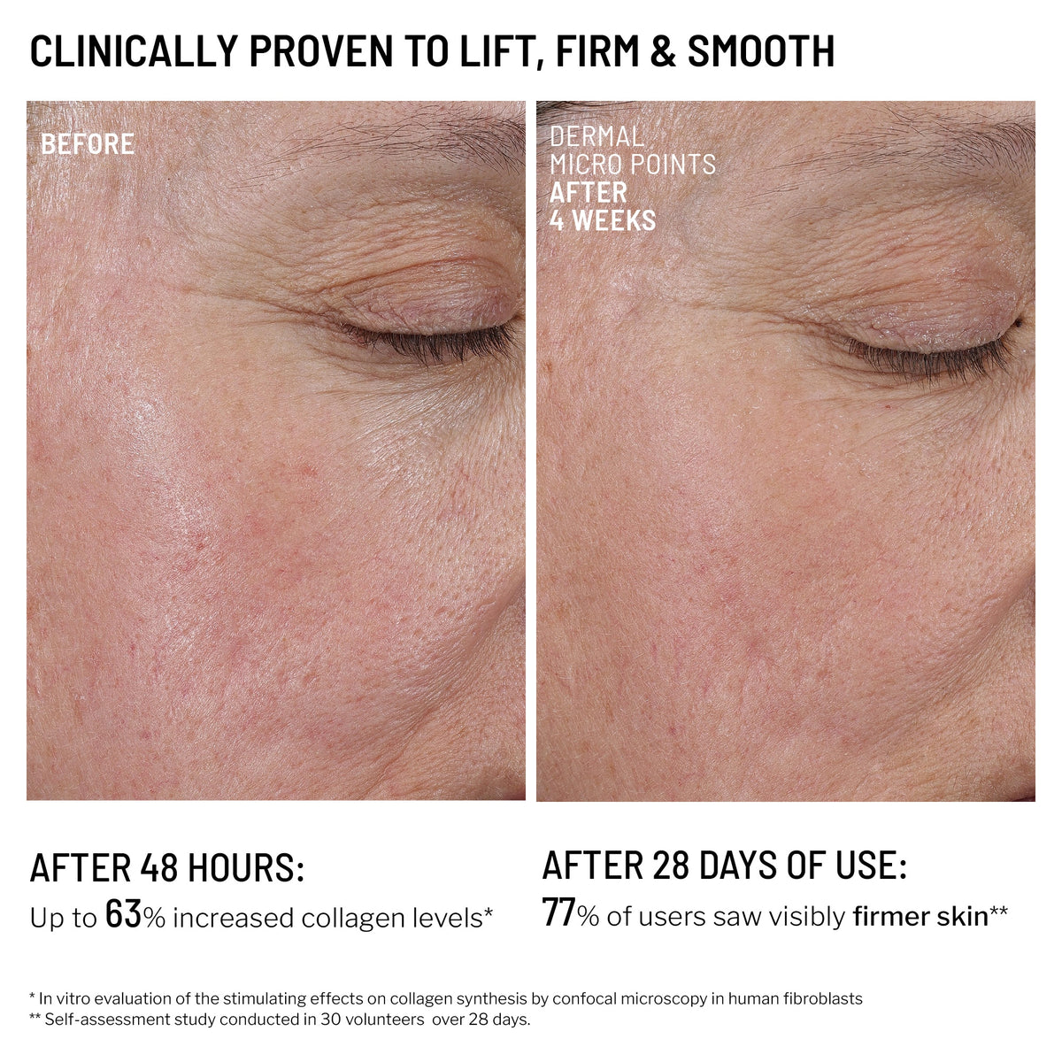 Microneedling Recovery Duo + Holiday Sleeve