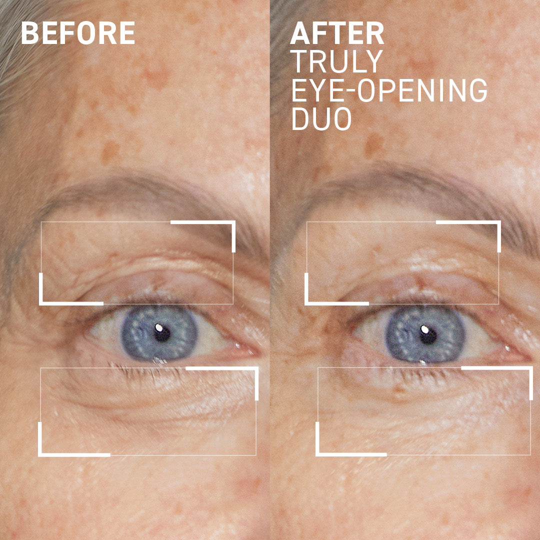 Eye Lifting & Brightening Duo