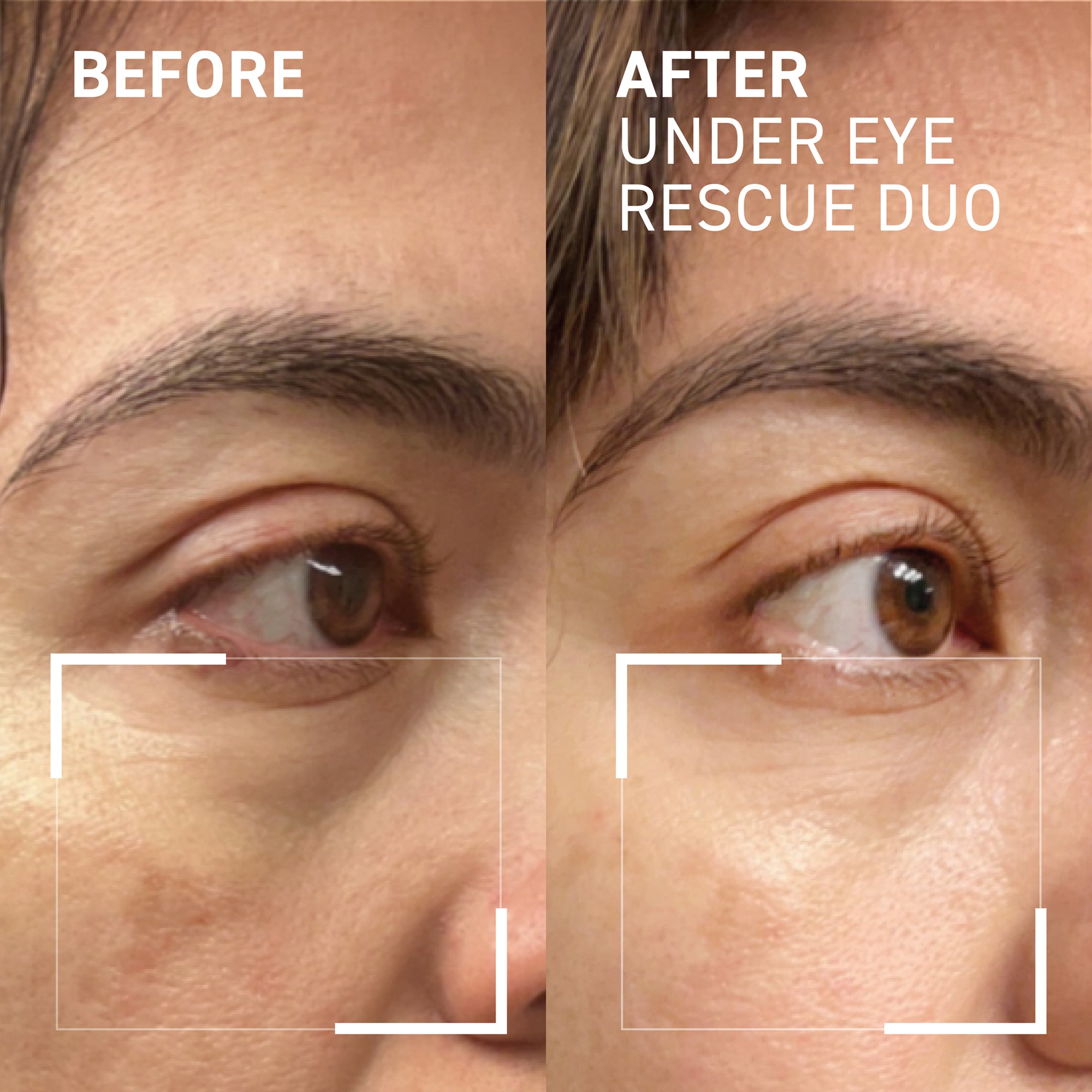 Eye Puffiness & Fatigue Duo