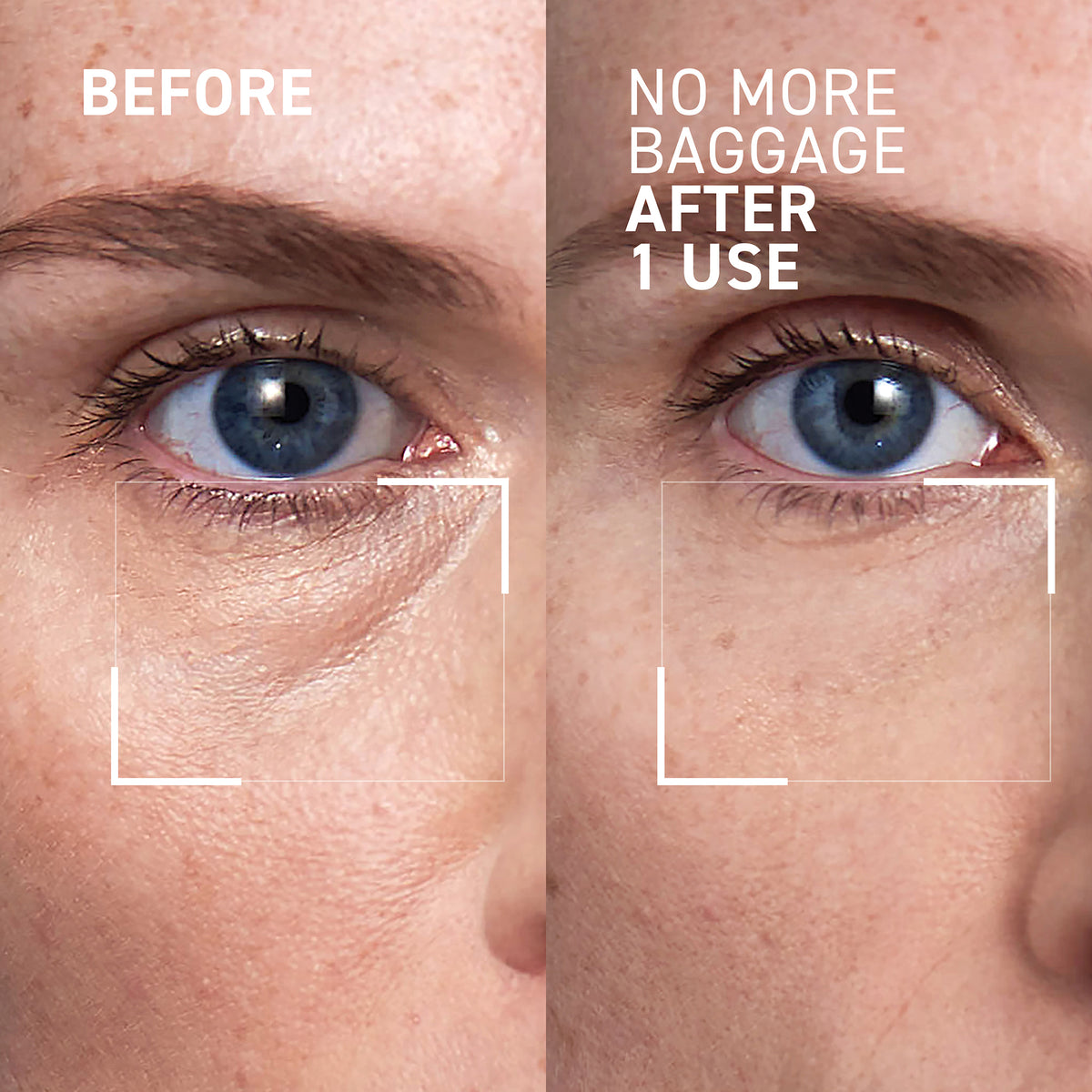 No More Baggage - Jumbo Size