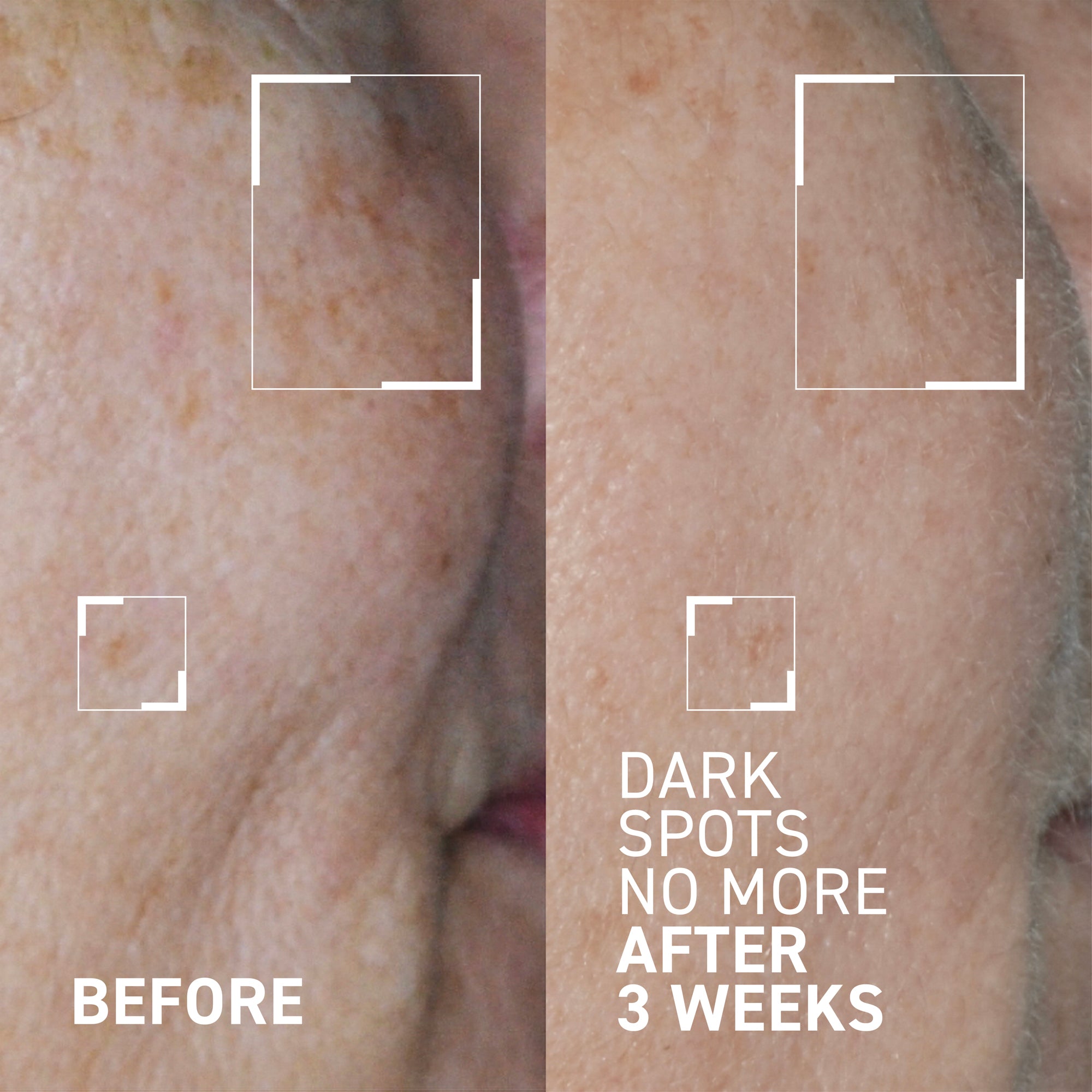 DARK SPOTS NO MORE