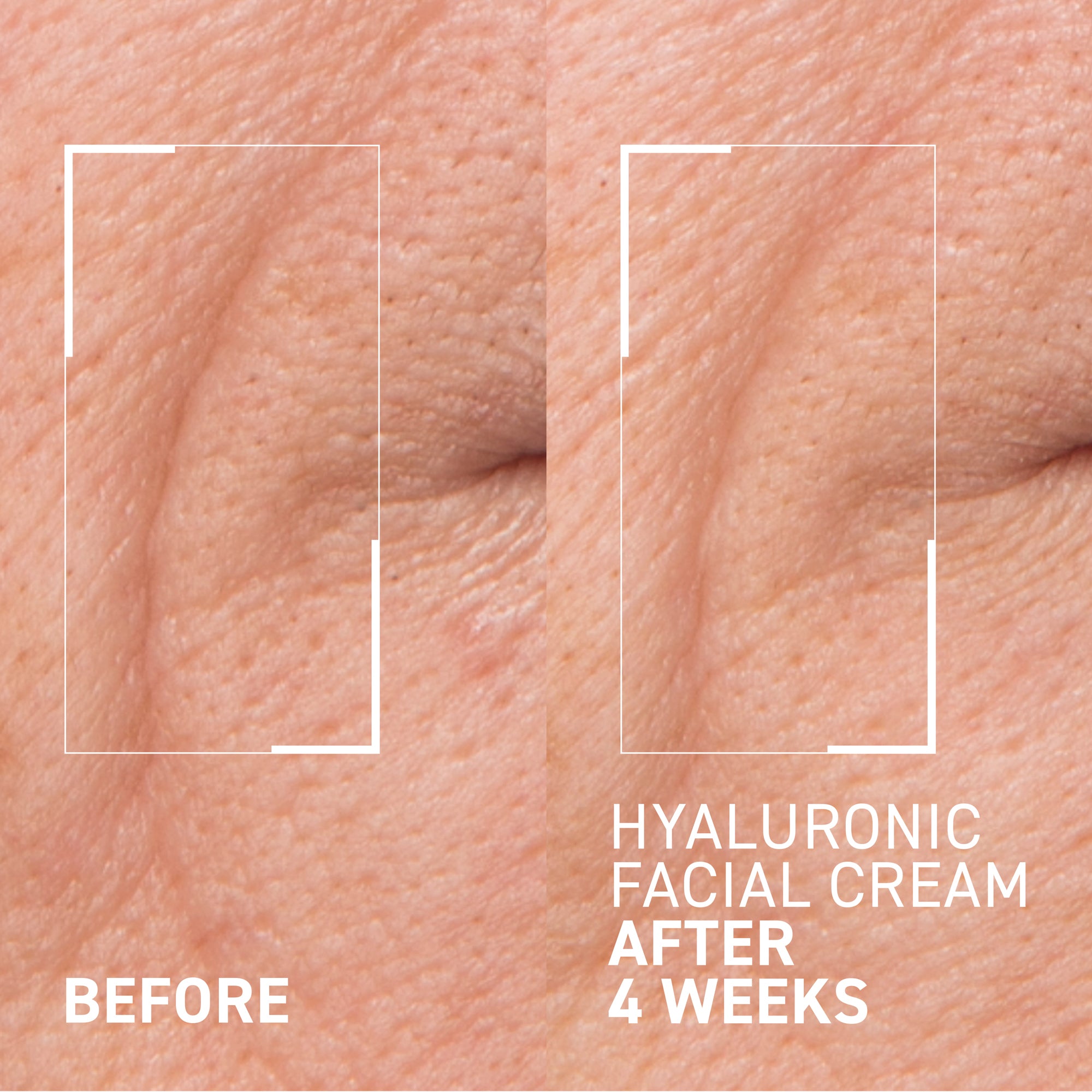 HYALURONIC FACIAL CREAM