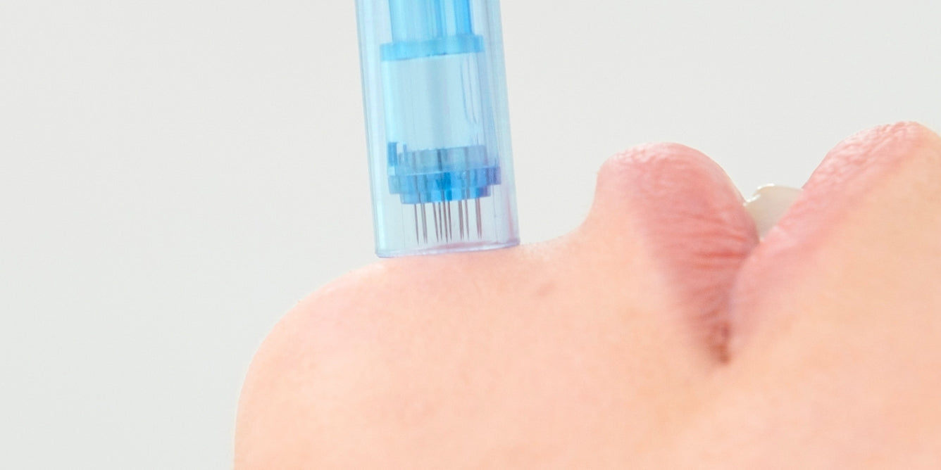 Microneedling: The Trend, The Truth, and The Game-Changing Alternative