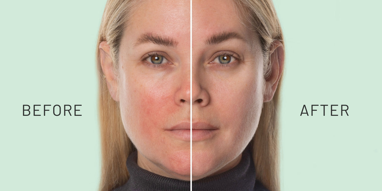 Skin Barrier Basics: Your Guide to Calm, Balanced Skin