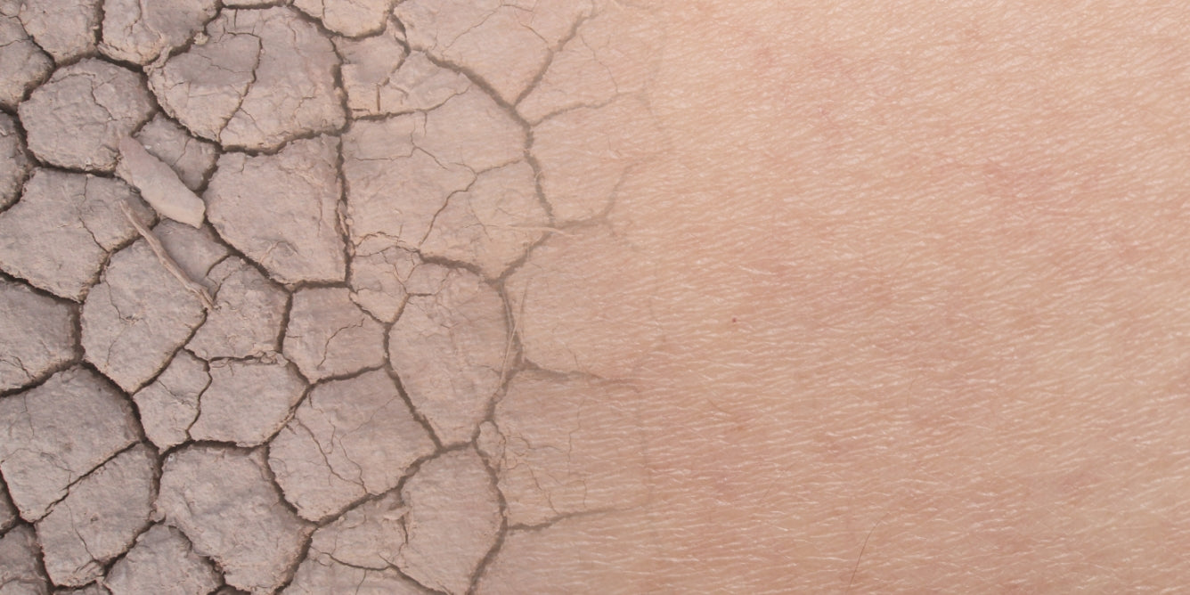 4 tips to get rid of dry skin