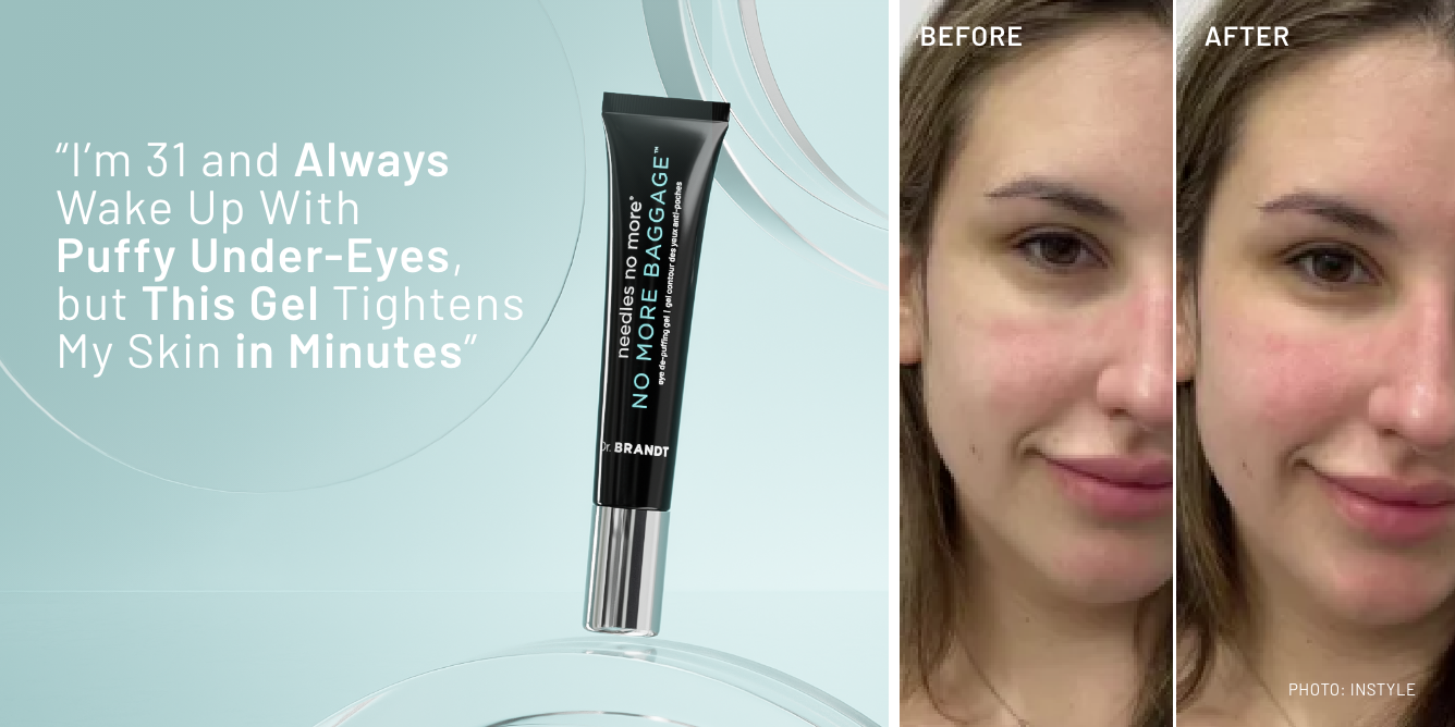 “I'm 31 and Always Wake Up With Puffy Under-Eyes, but This Gel Tightens My Skin in Minutes”