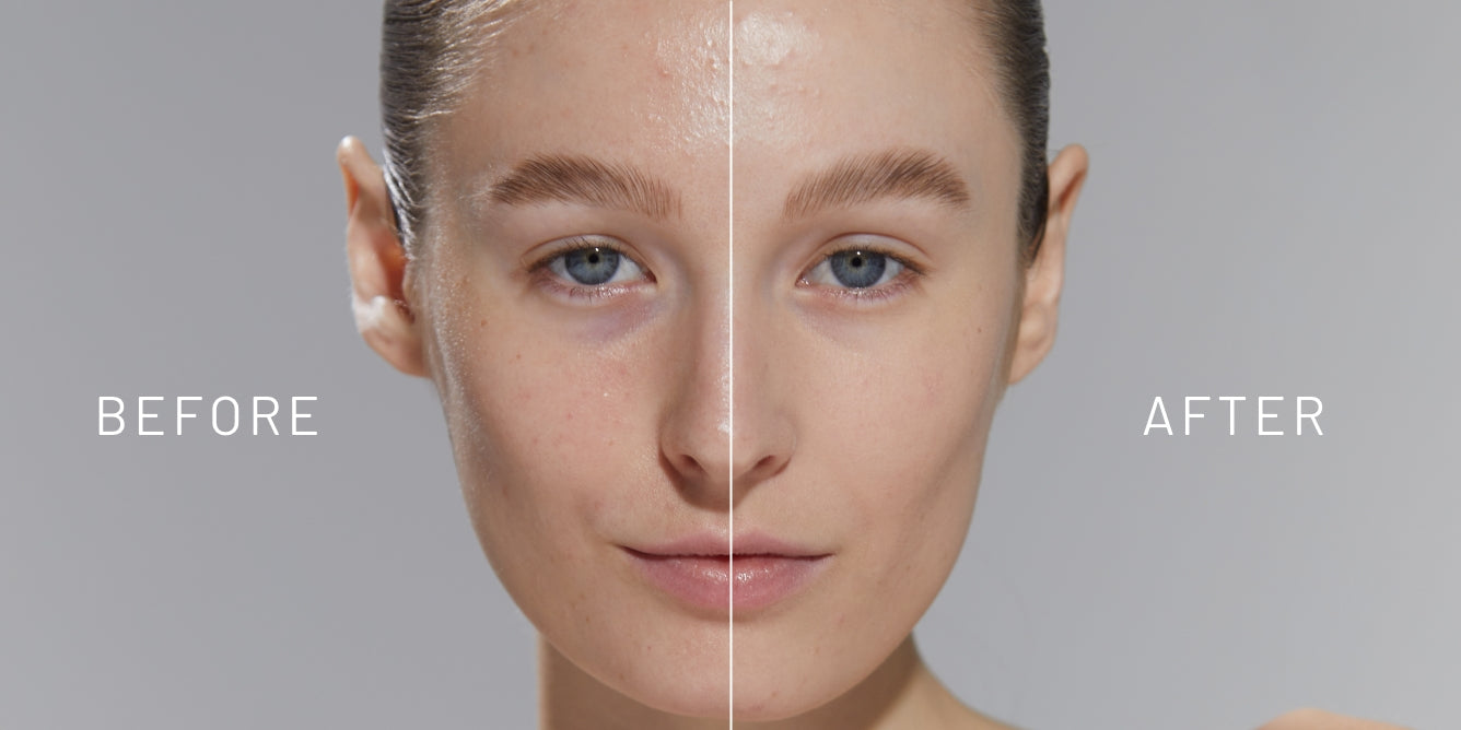 Shine Free and Poreless: How to Minimize Enlarged Pores