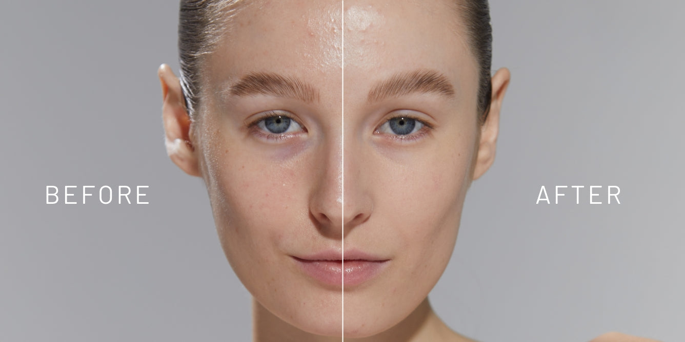 Shine Free and Poreless: How to Minimize Enlarged Pores - Dr. Brandt ...