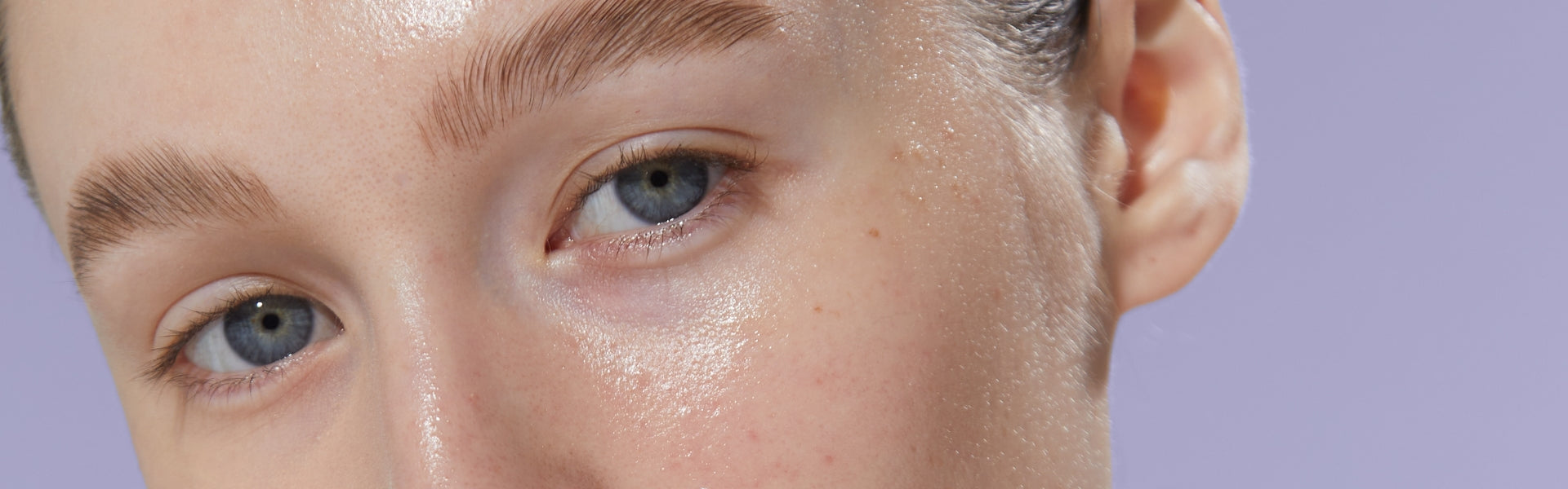 Acne Face Cream