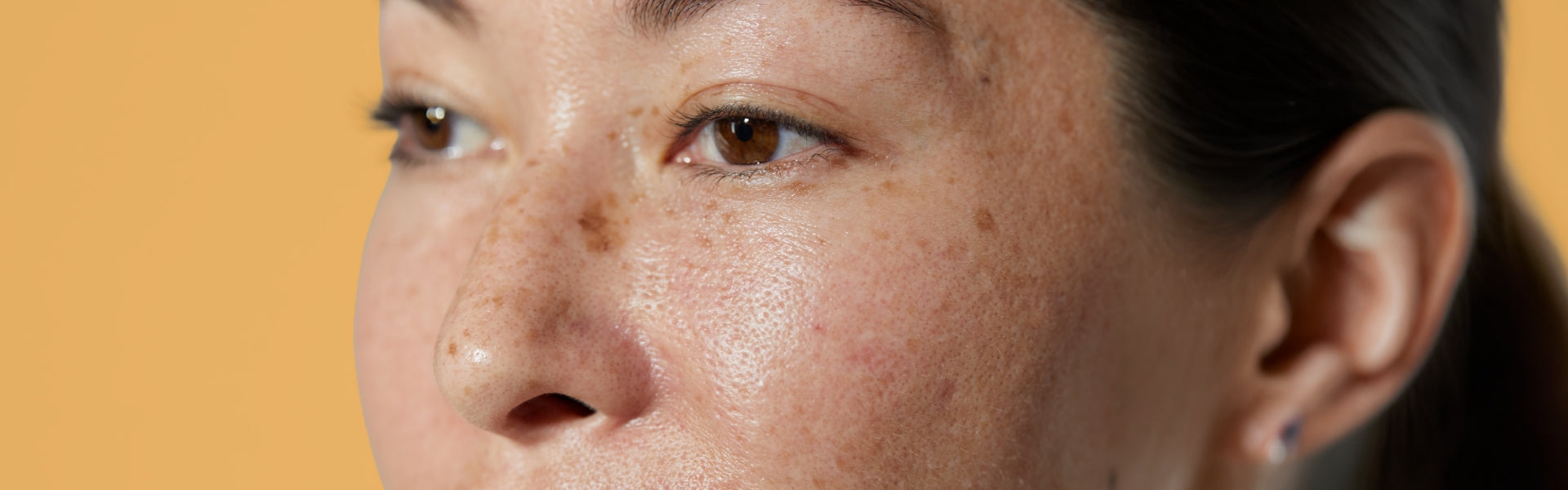 Uneven or Dull Skin