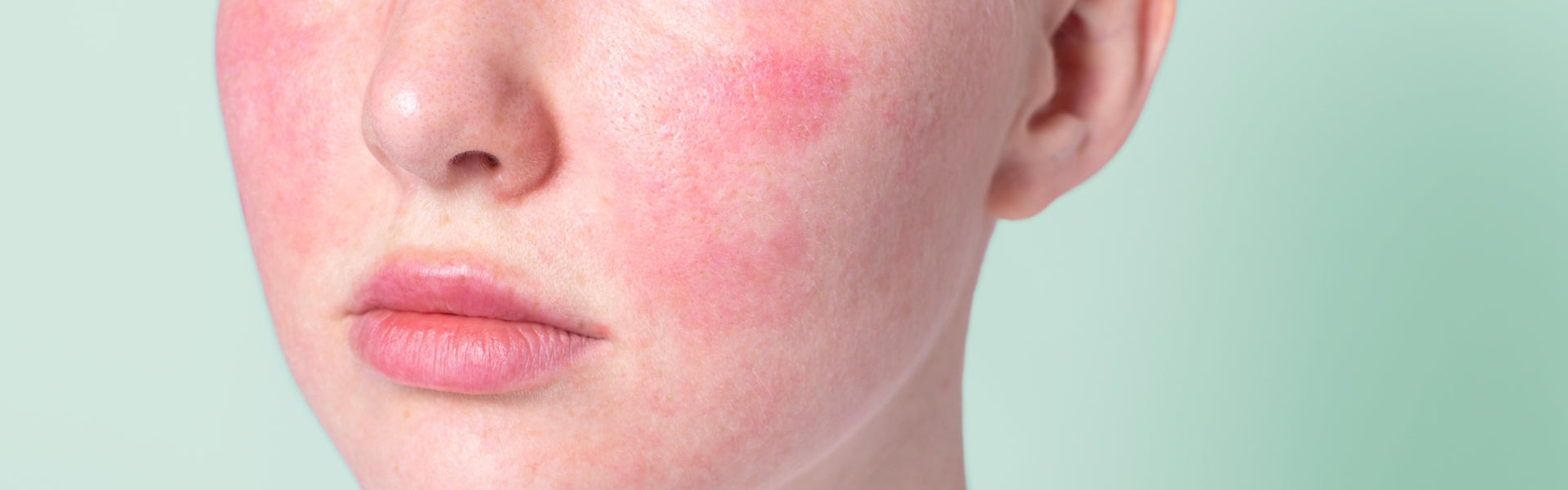 Sensitive Skin