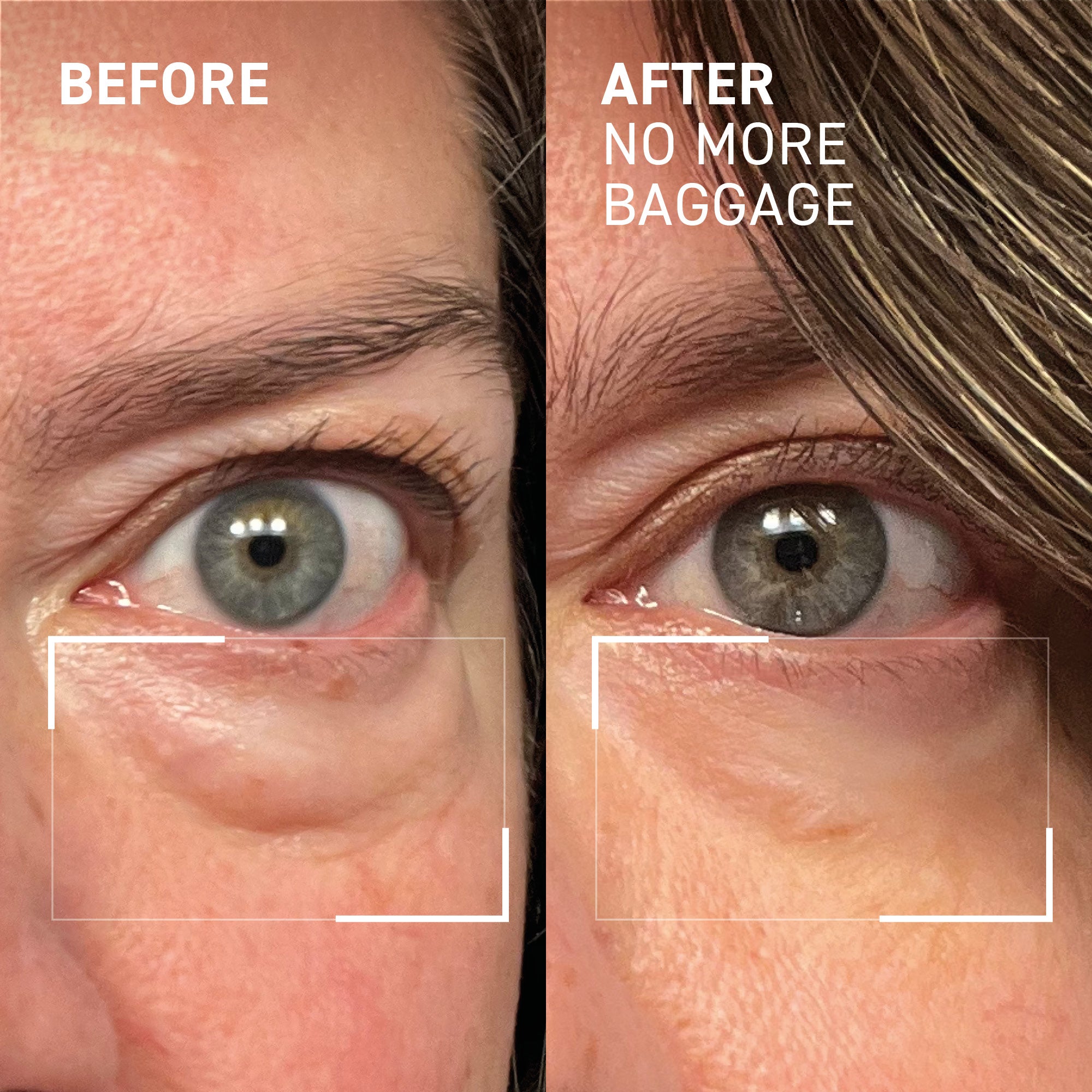 Dr. Brandt 0.5 oz No More Baggage Eye De-Puffing Skincare Gel for