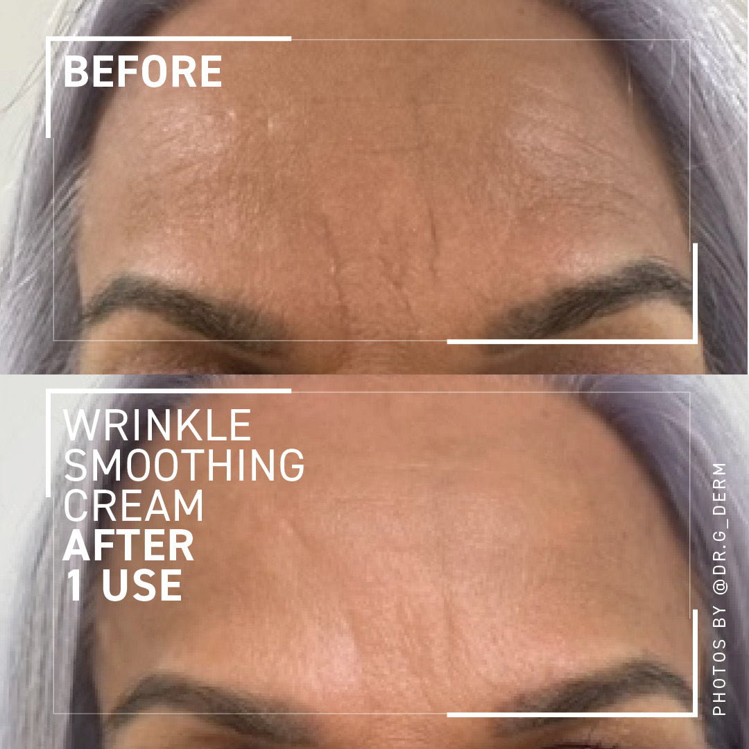Wrinkle Smoothing Cream