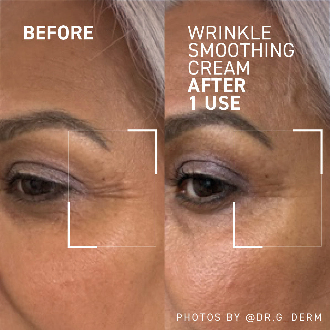 Face, Eye & Forehead Wrinkle Cream - Smooth & Reduce Wrinkles Fast