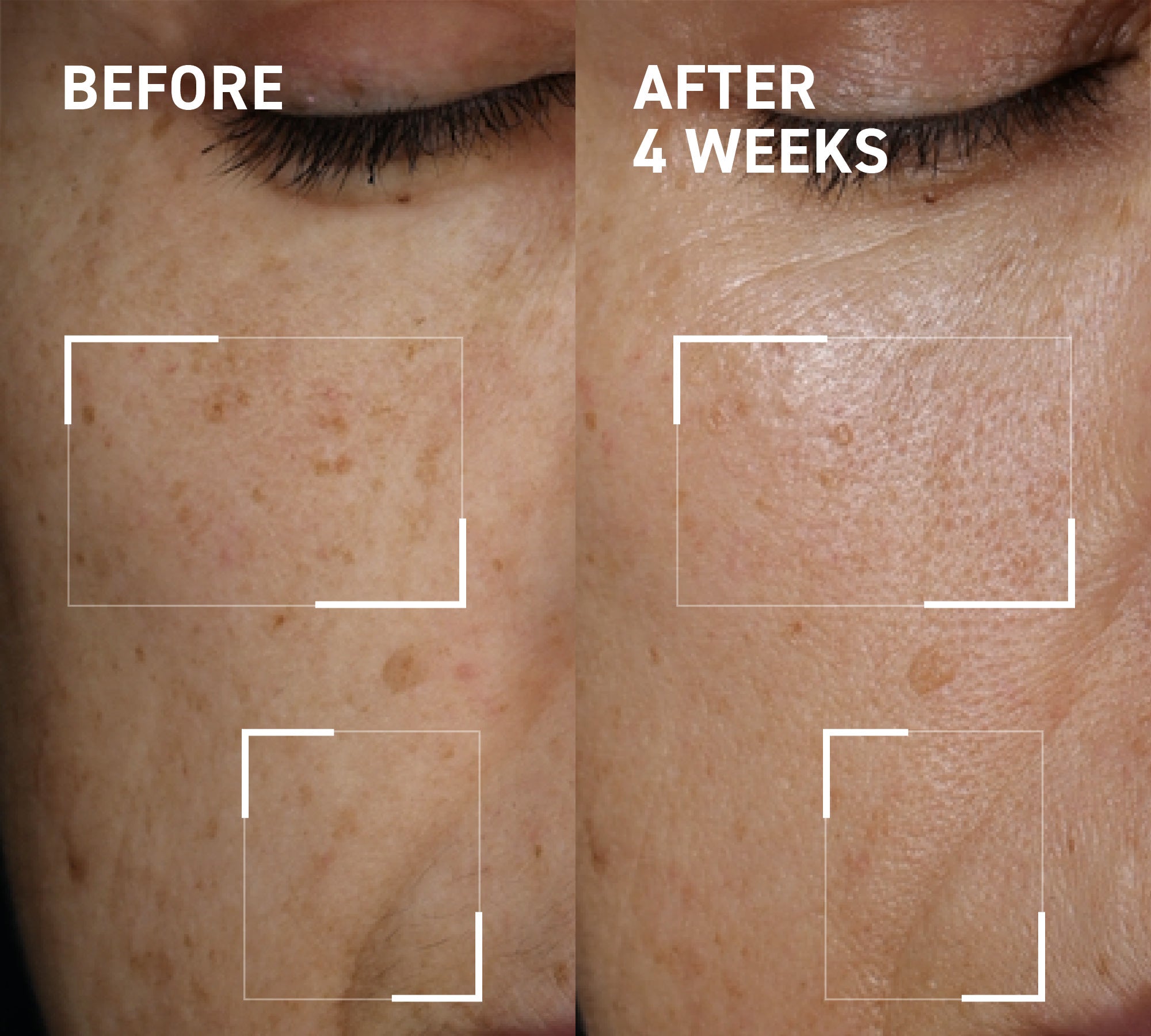 Microneedling Glow Duo