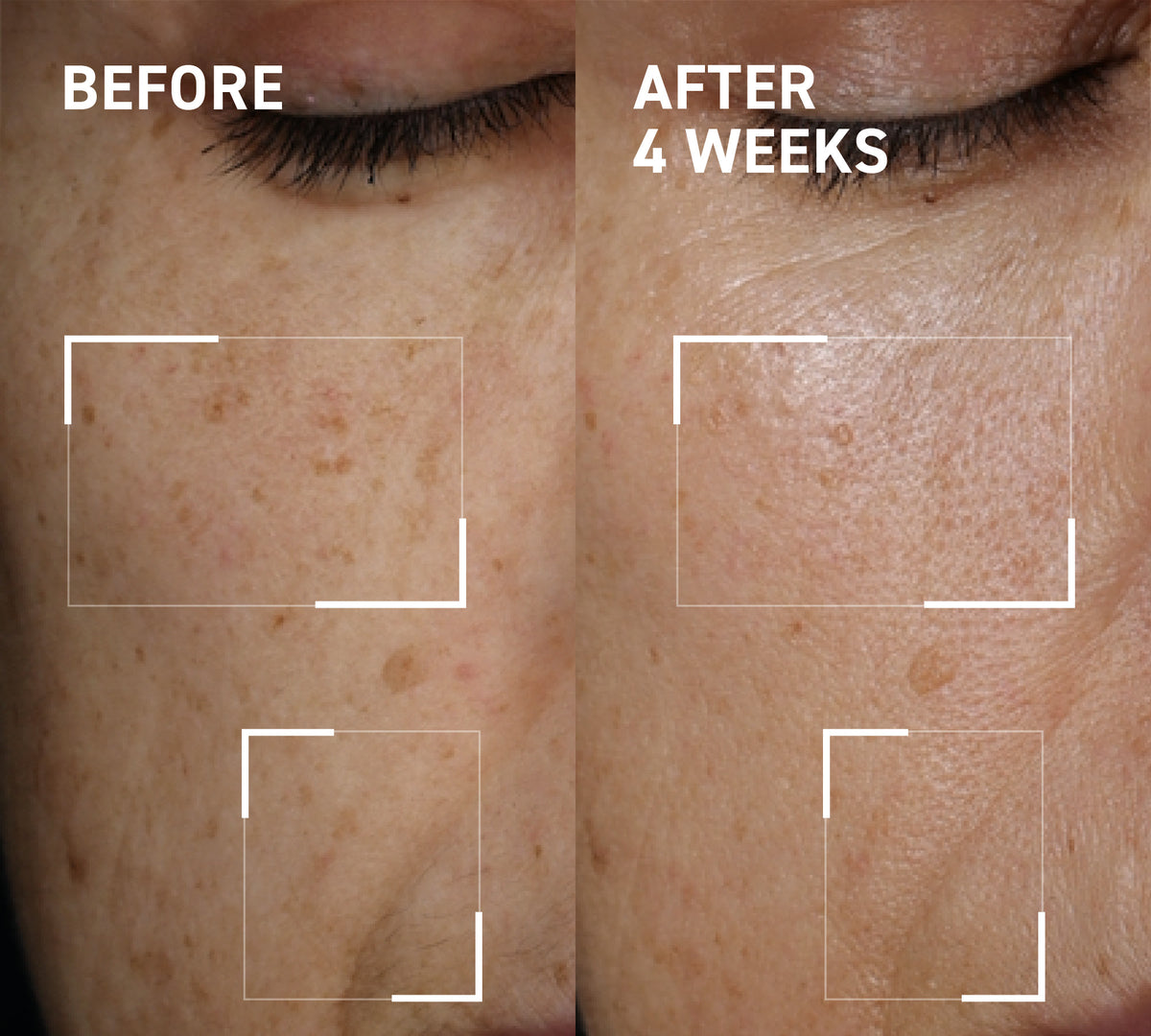 Microneedling Glow Kit