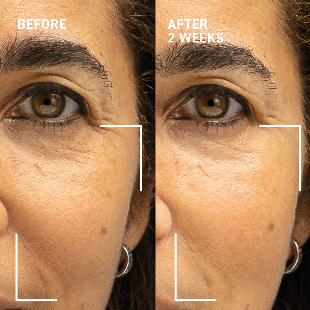 Microneedling Rejuvenating Kit