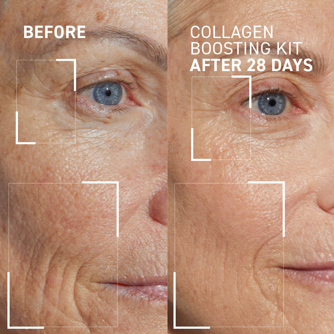 COLLAGEN CONTROL KIT