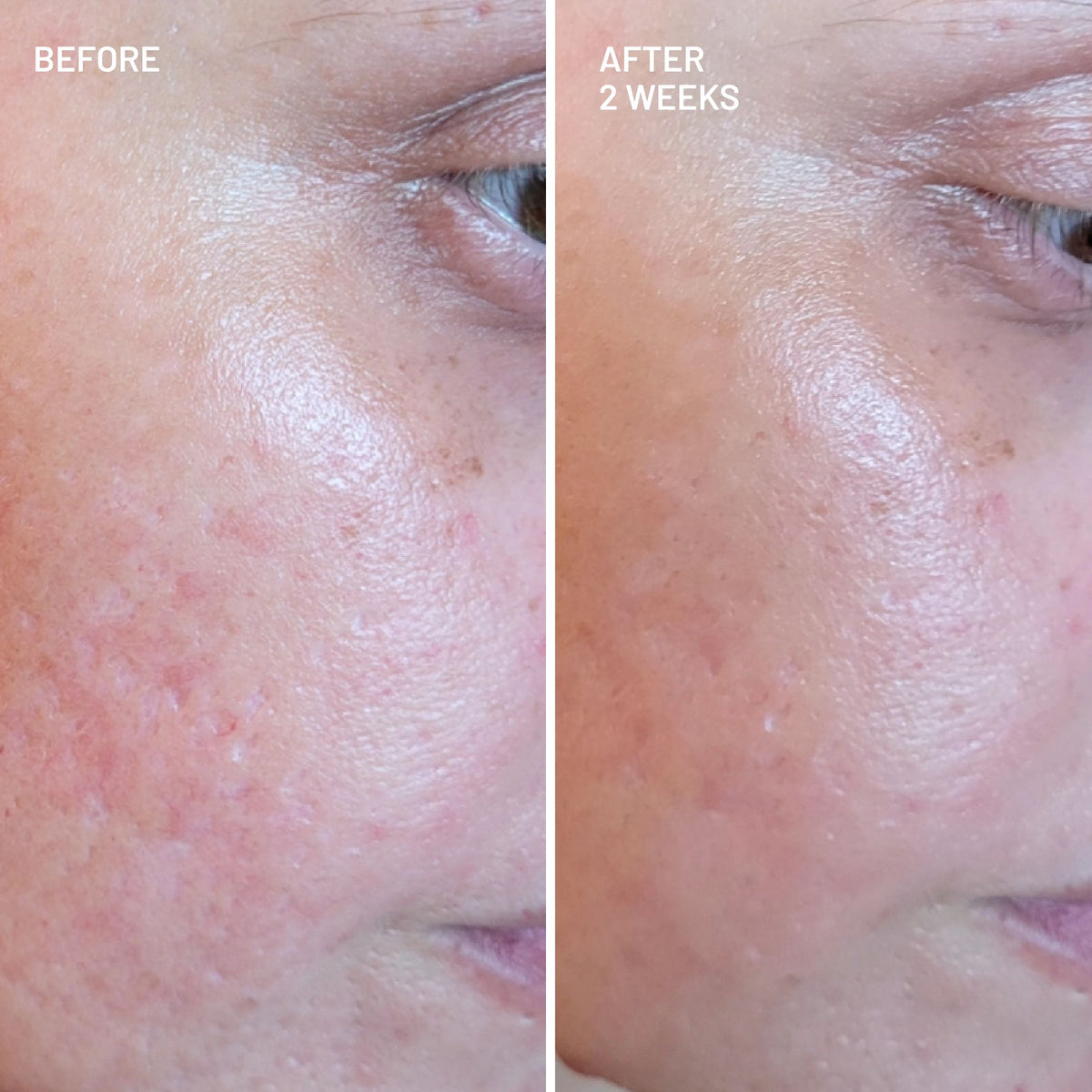 Gentle Radiance Cleansing Duo