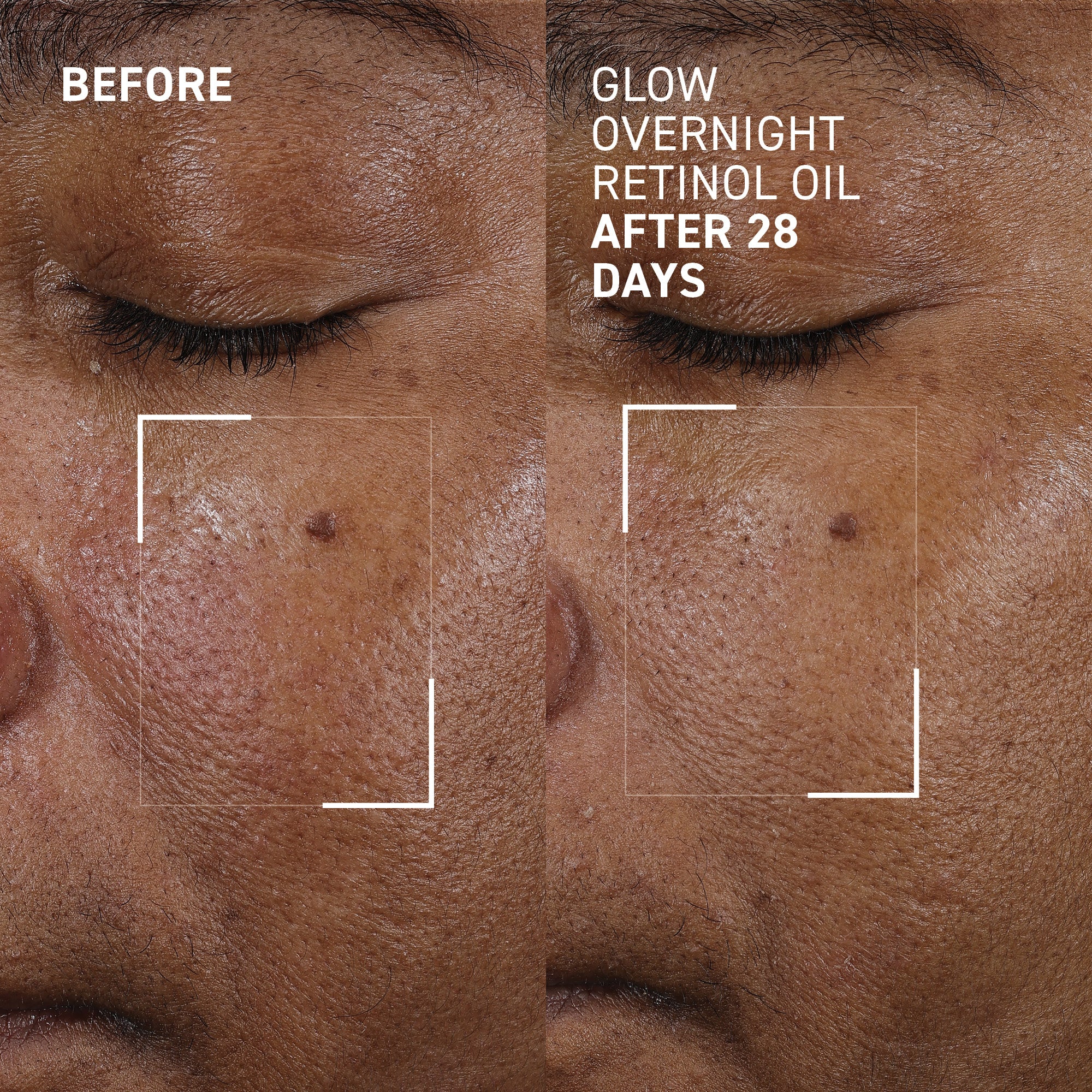 Glow Overnight Retinol Oil