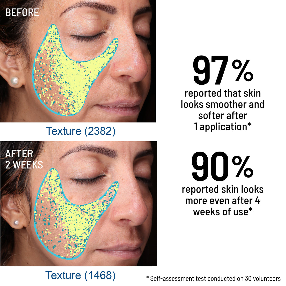 Advanced Face Exfoliator