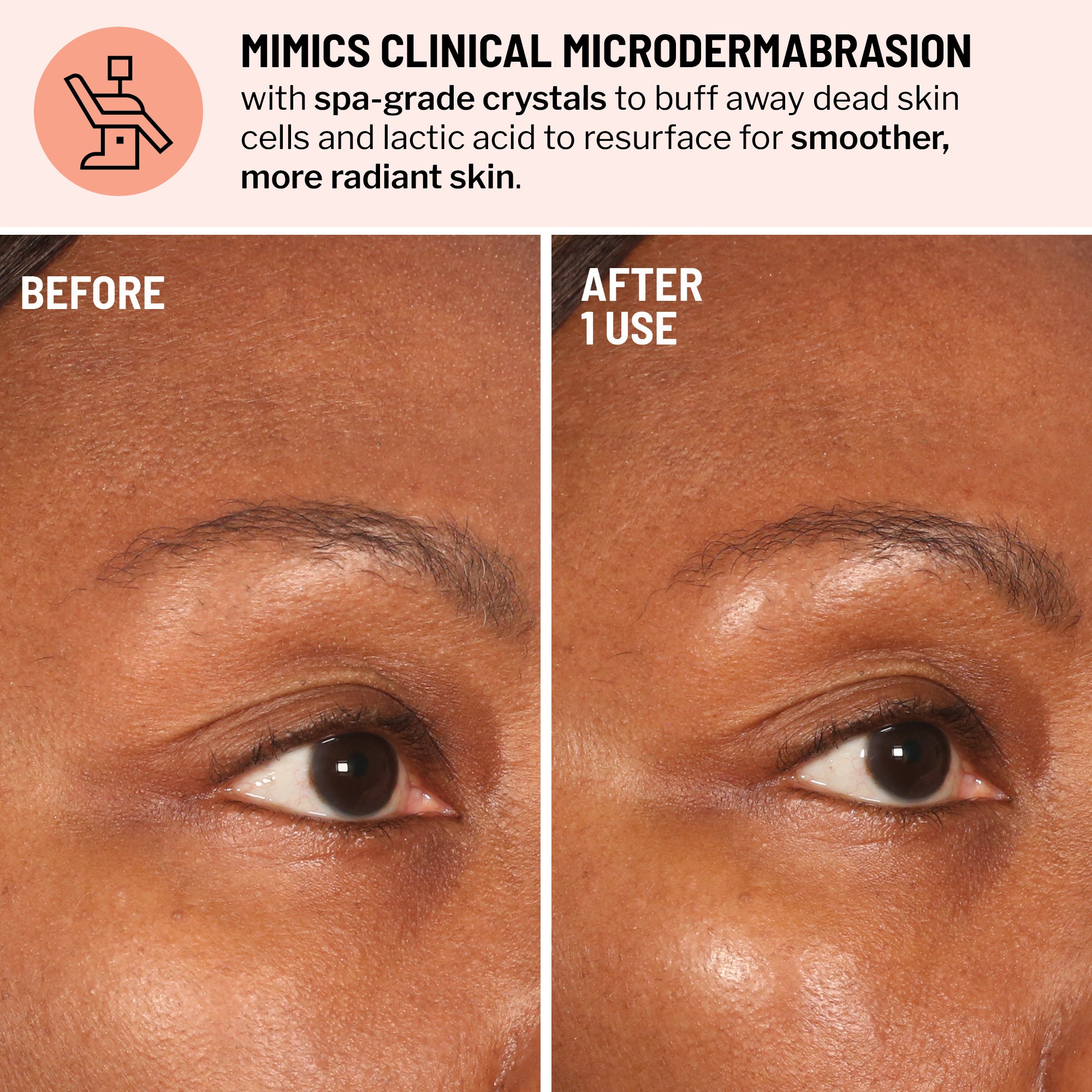 Advanced Face Exfoliator