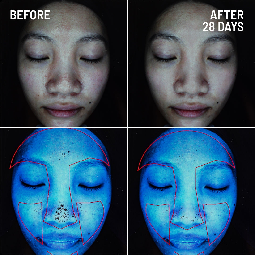 Gentle Microdermabrasion Face Exfoliator