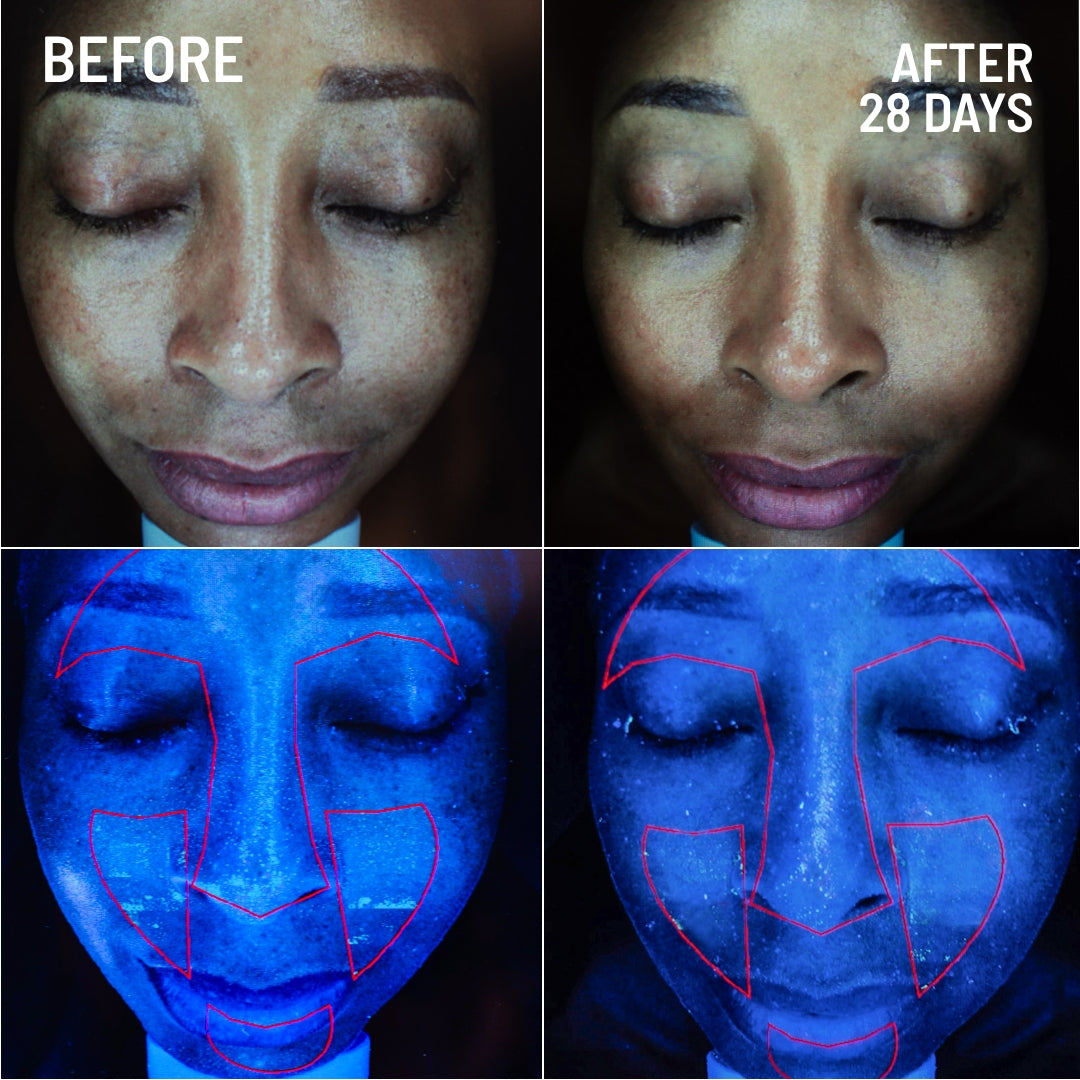 Gentle Microdermabrasion Face Exfoliator