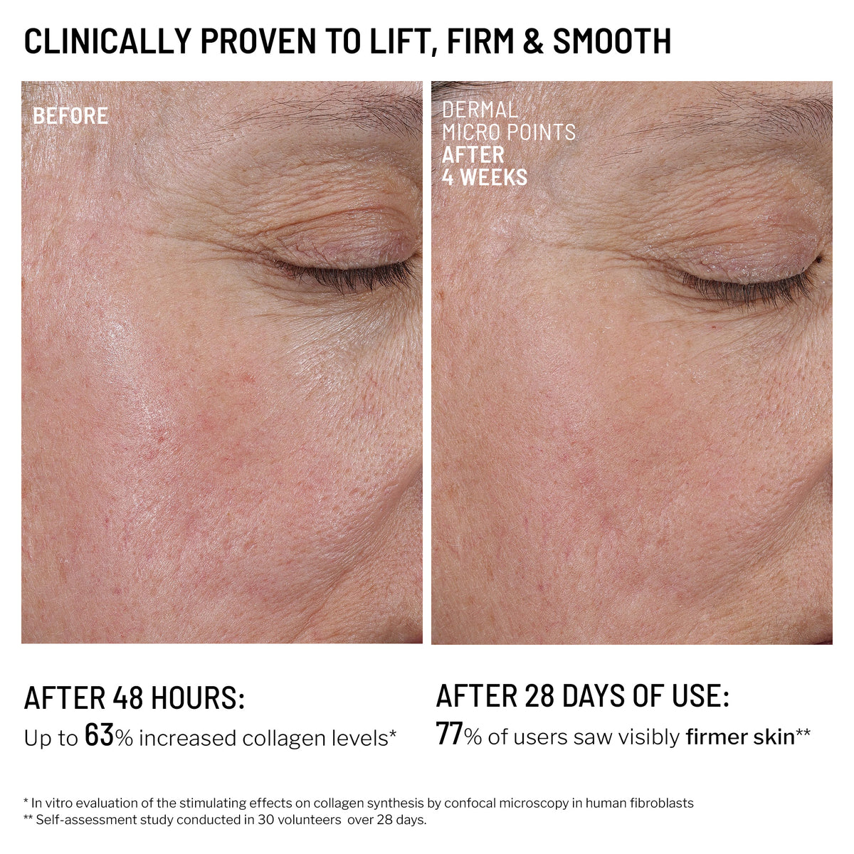 Microneedling Recovery Kit