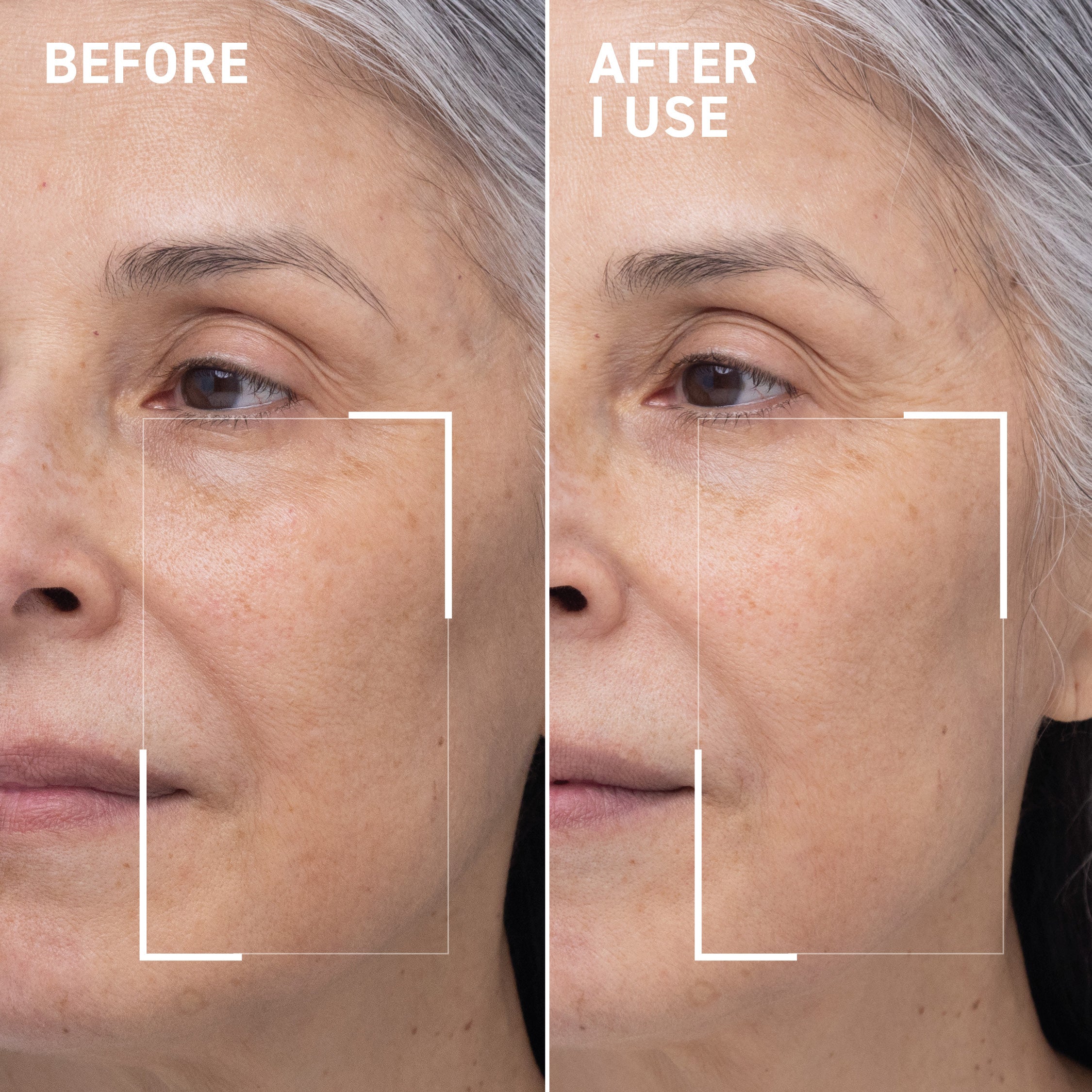 Oxygen Facial Duo