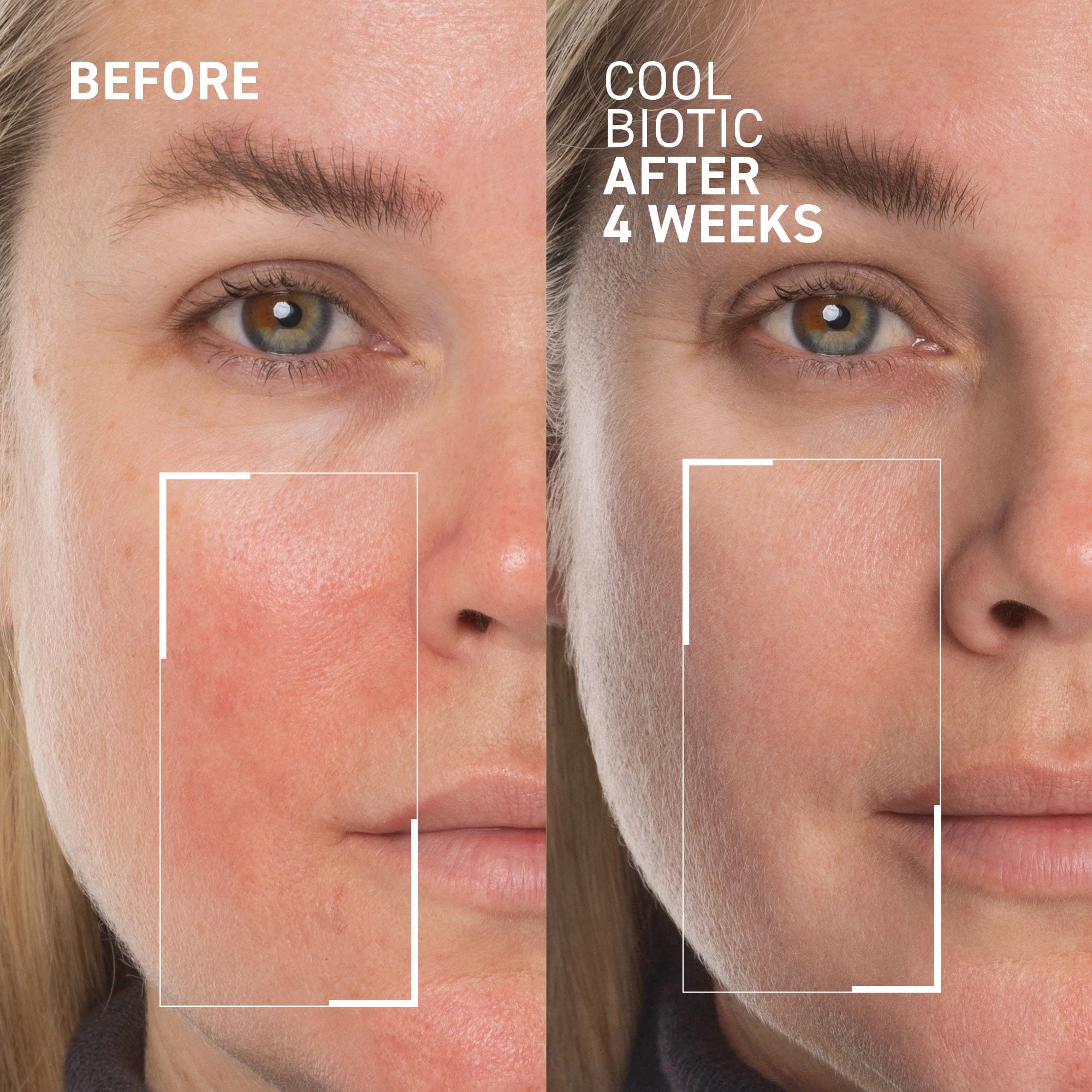 Redness relief cream - Cool Biotic I Dr. Brandt Skincare