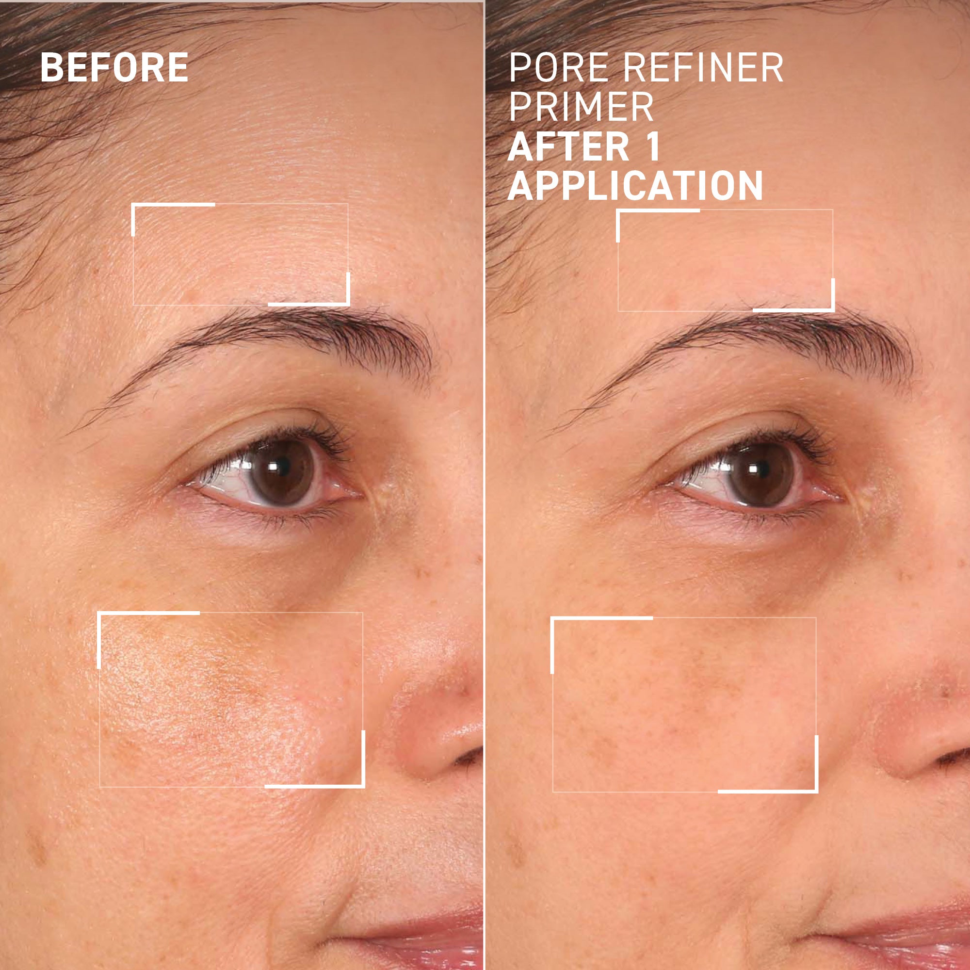 Complexion Booster Kit