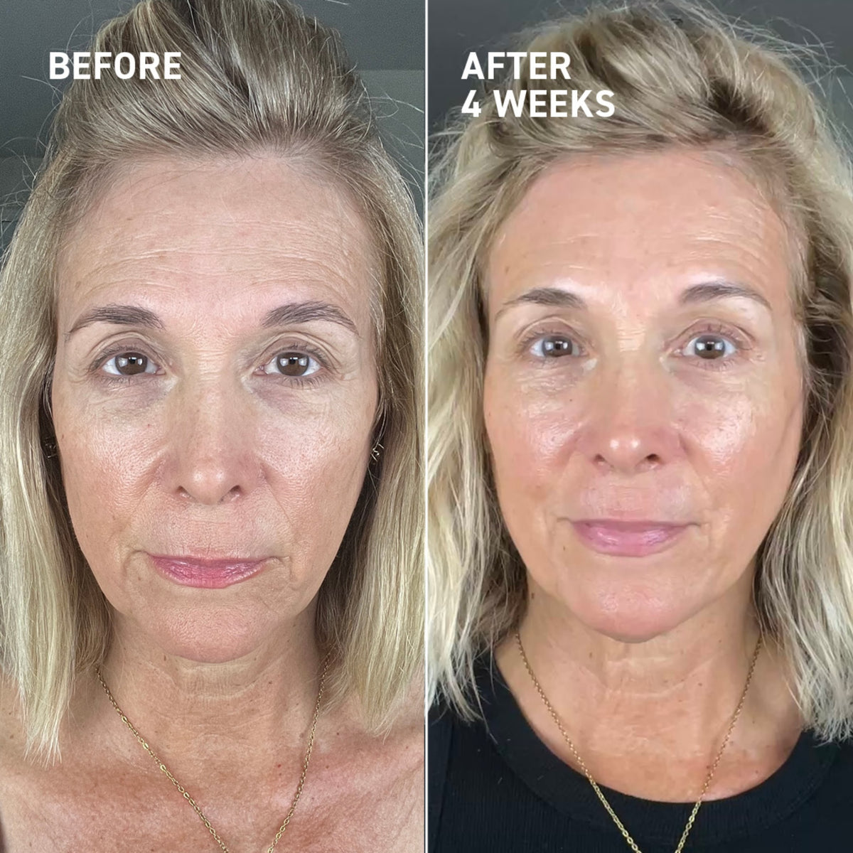 Microneedling Recovery Duo + Holiday Sleeve
