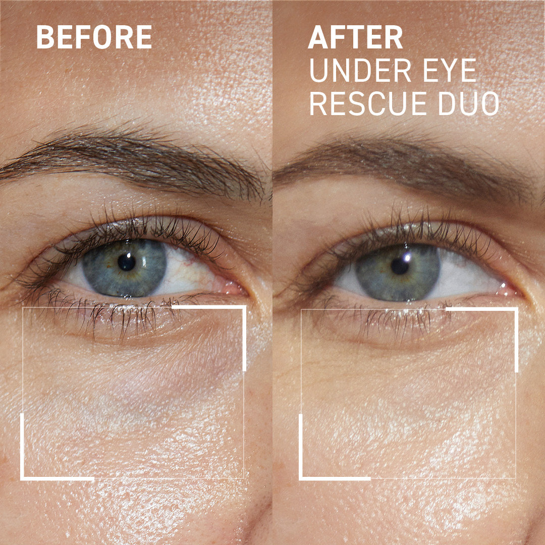 EMBEAGE EMPYREAN EYE 20g スパチュラ付き Eye Puffiness & Fatigue Duo - Dr. Brandt Skincare